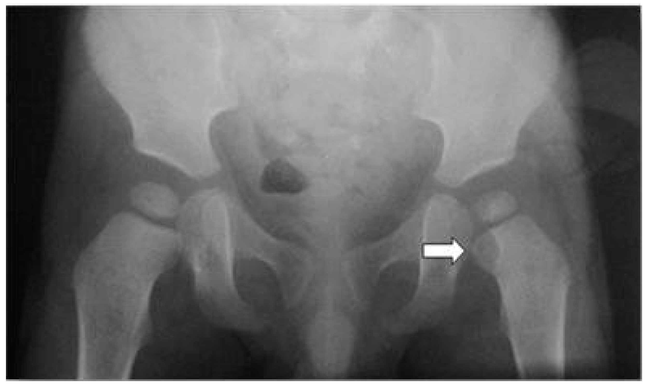 Ijerph 13 00539 g001