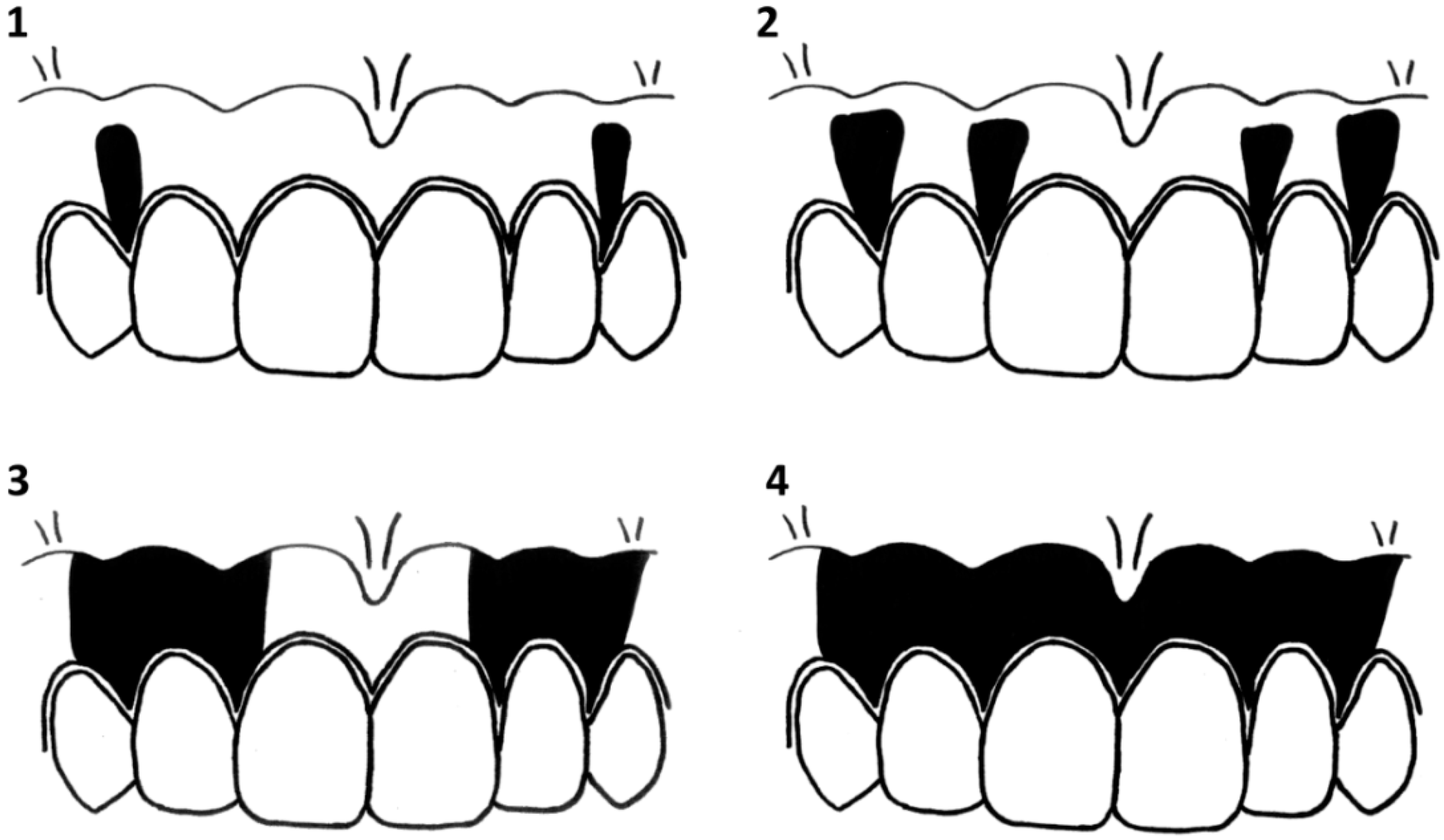 Ijerph 13 00598 g002