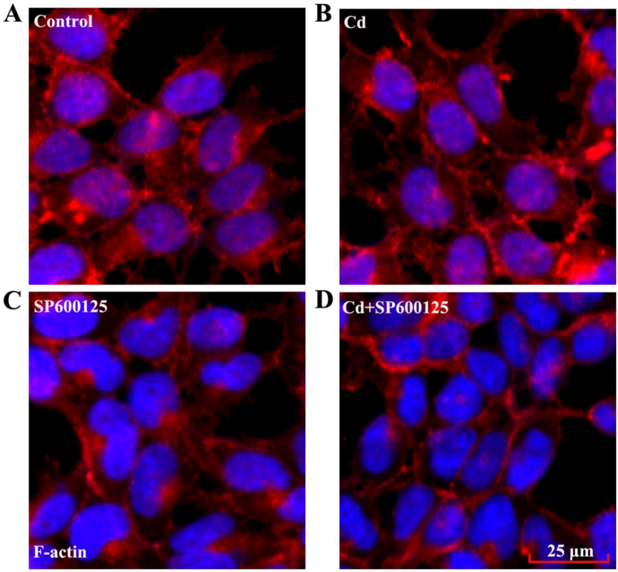 Ijerph 13 00990 g005