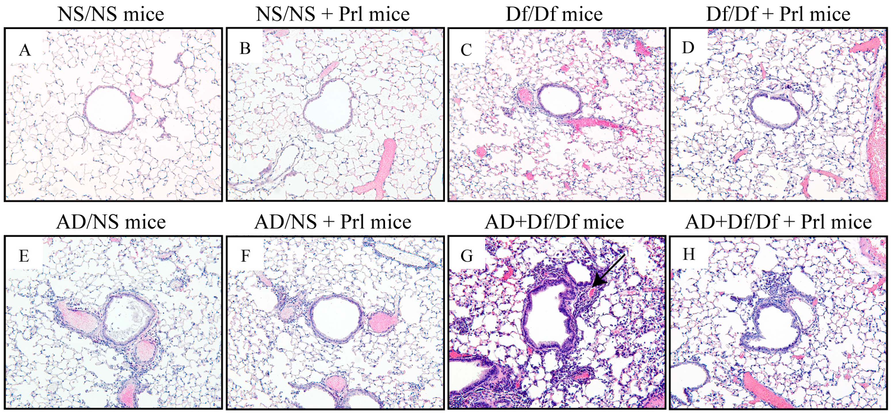 Ijerph 13 01144 g004