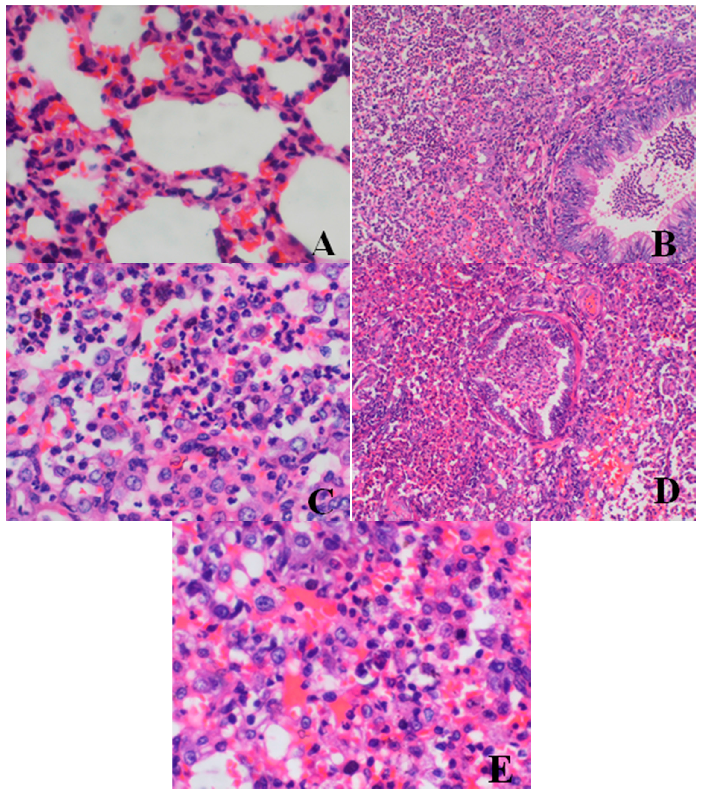 Ijerph 13 01190 g003