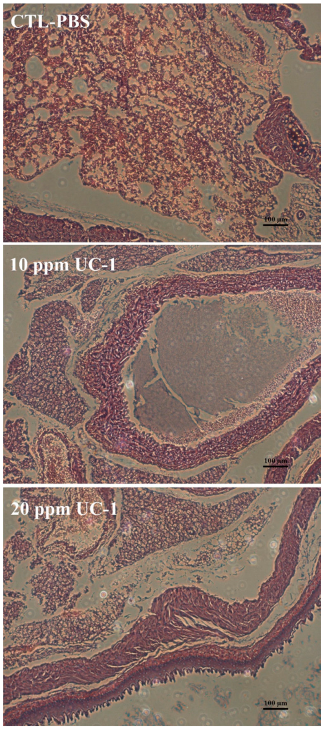 Ijerph 14 00329 g004