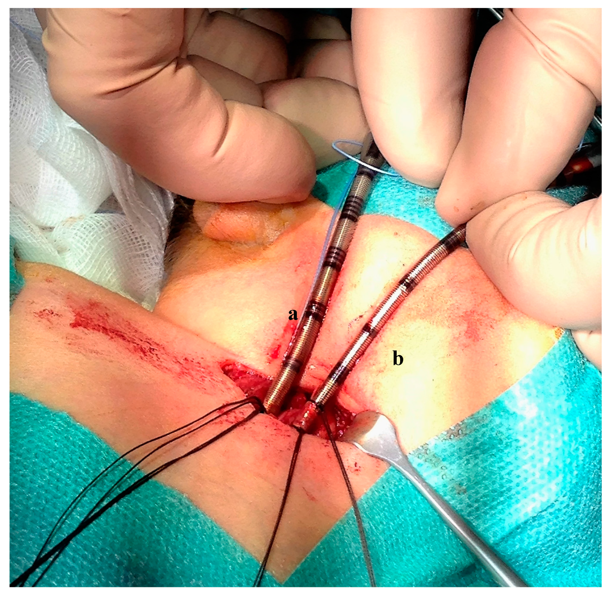 Ijerph 14 00360 g001