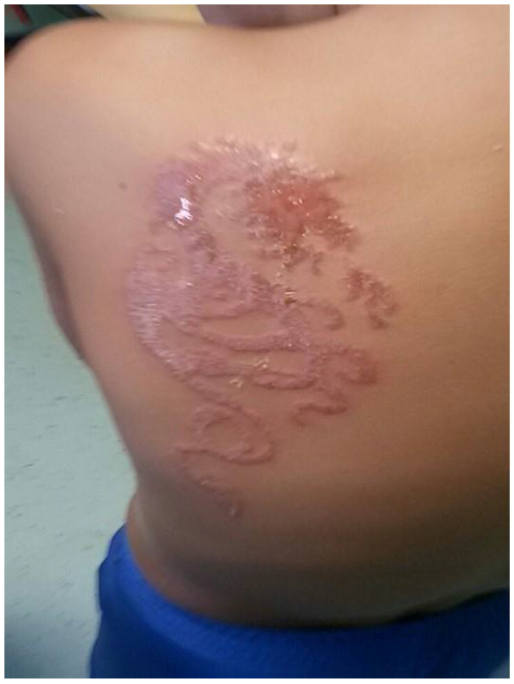 Ijerph 14 00421 g002