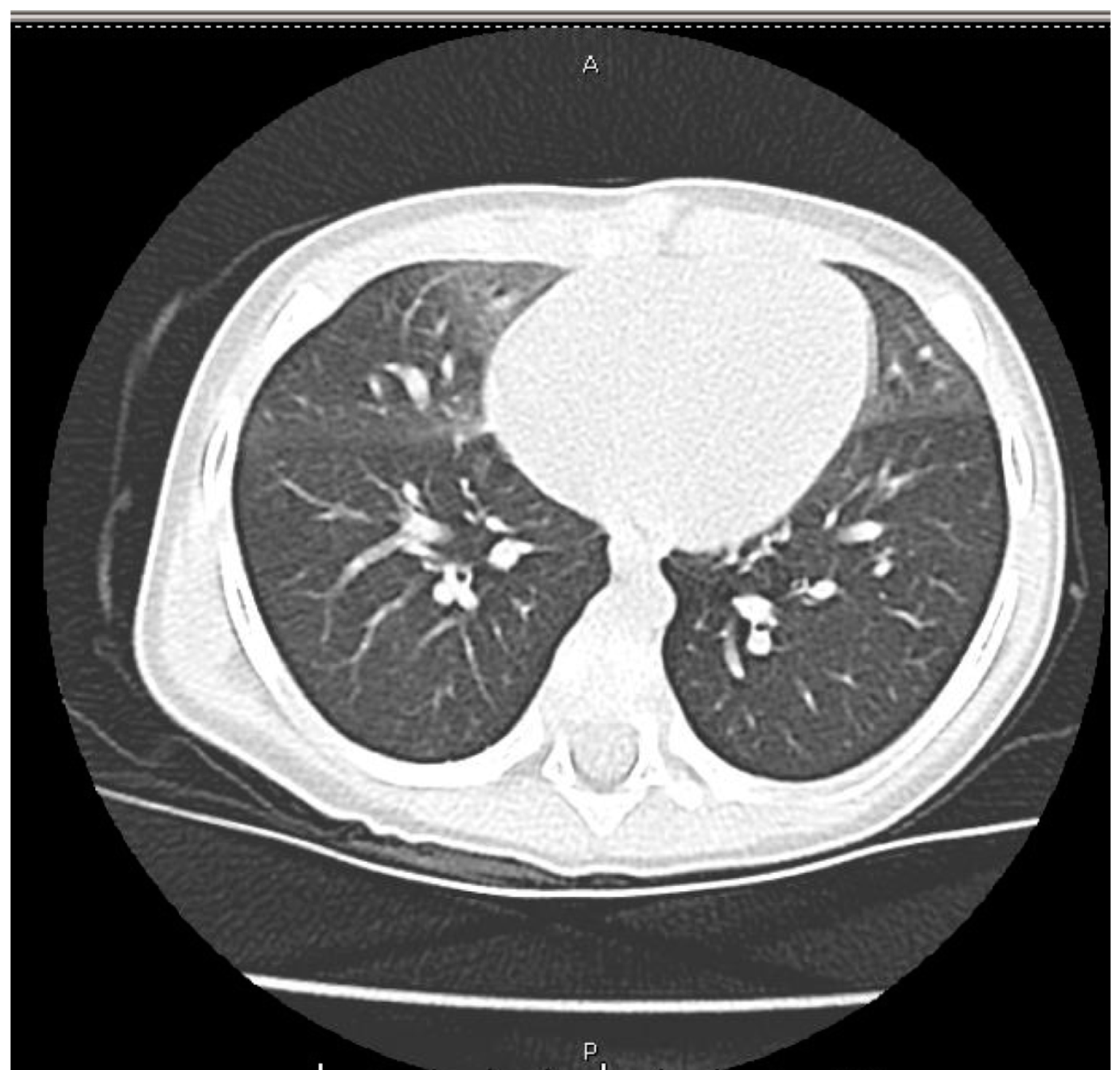 Ijerph 14 01113 g002