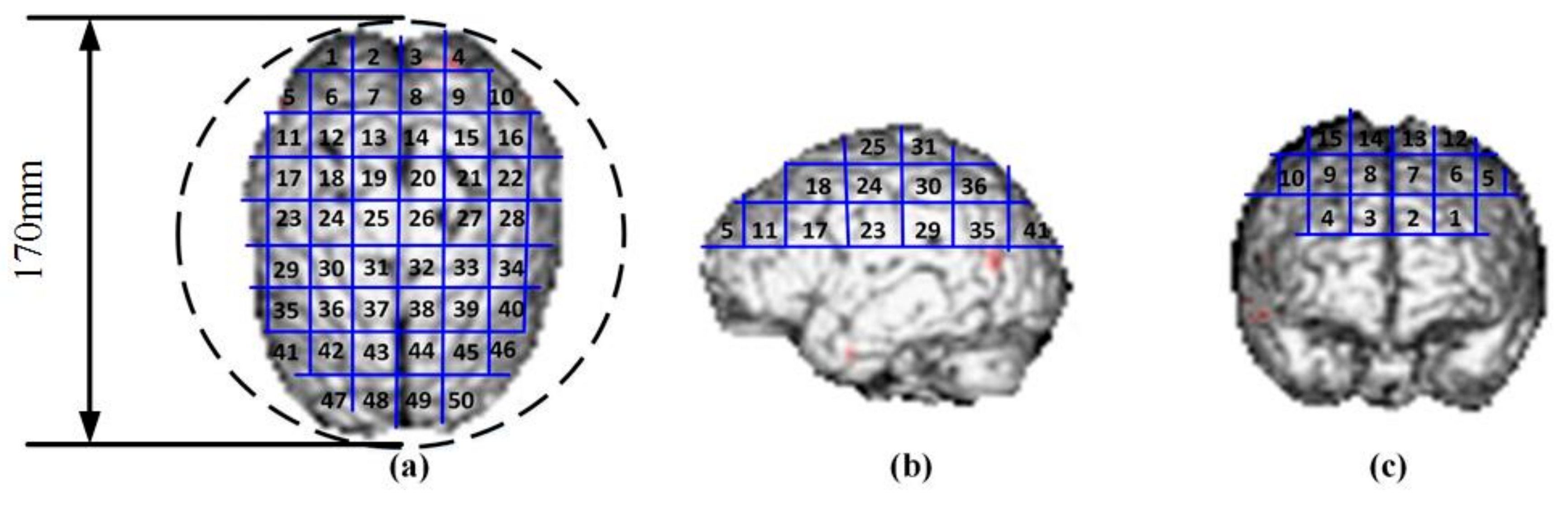 Ijerph 14 01388 g001
