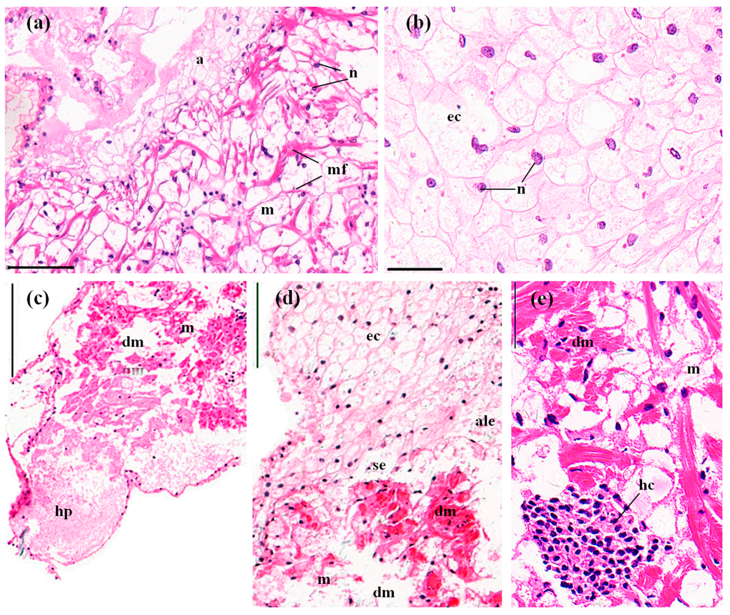 Ijerph 14 01466 g004