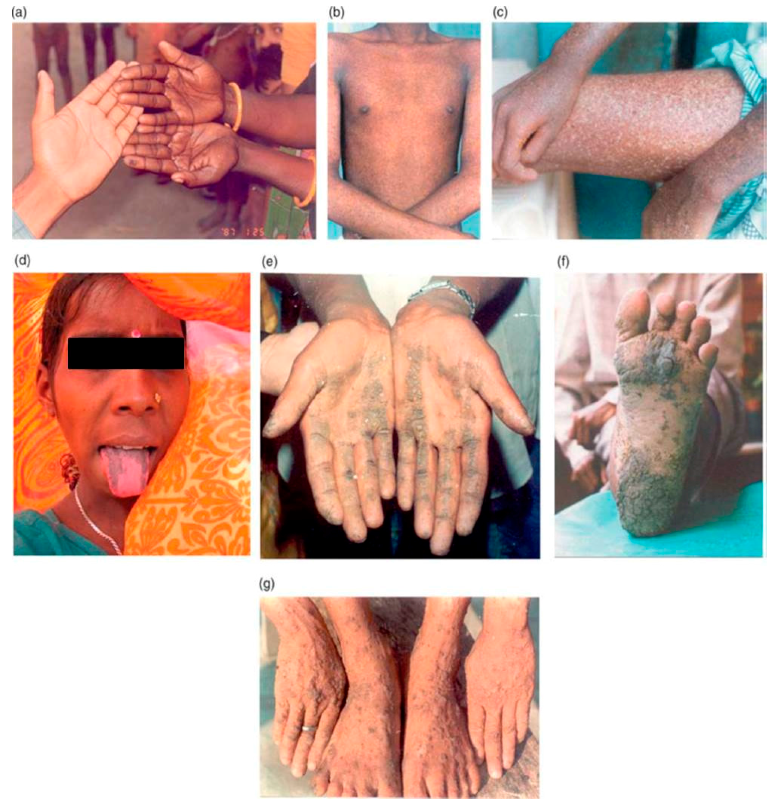 Ijerph 15 00180 g002