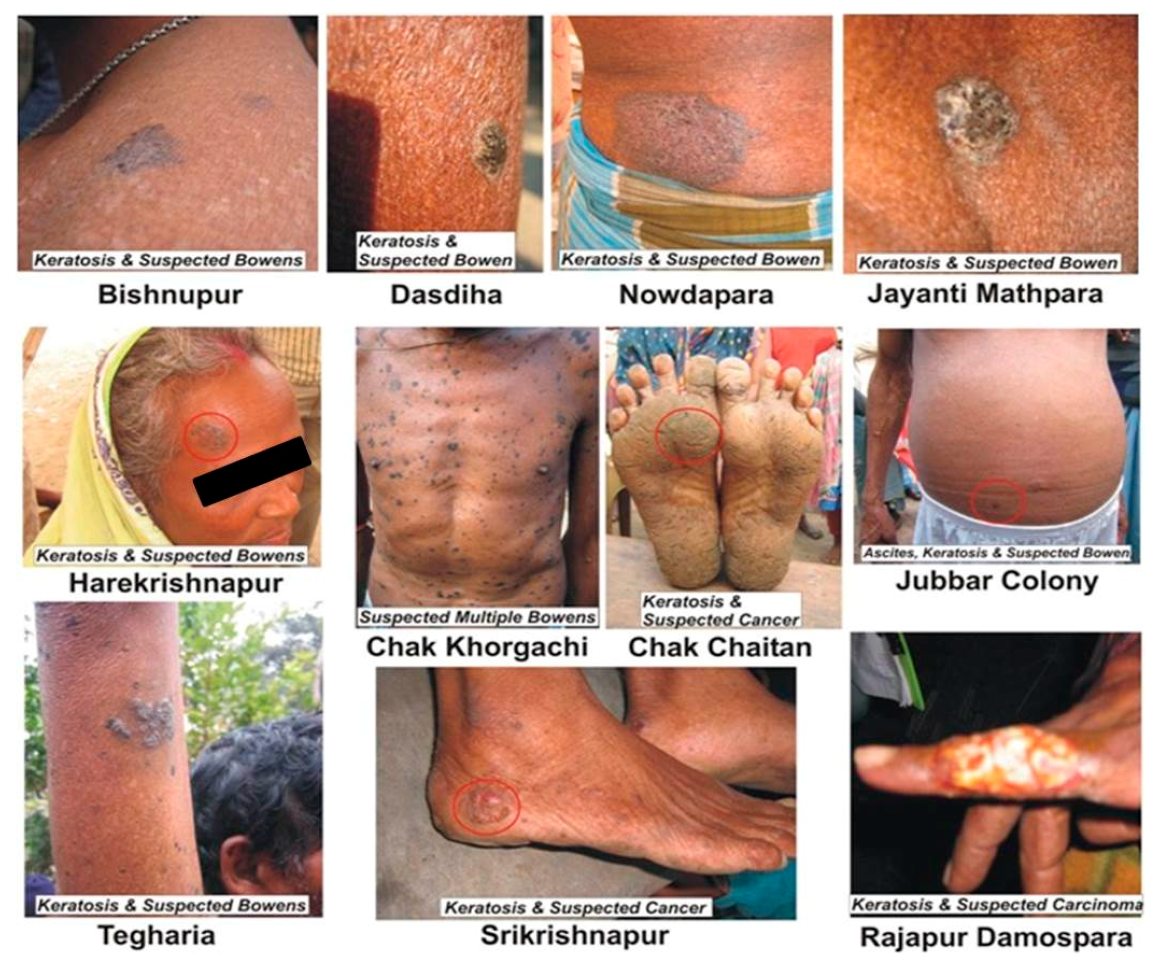 Ijerph 15 00180 g003