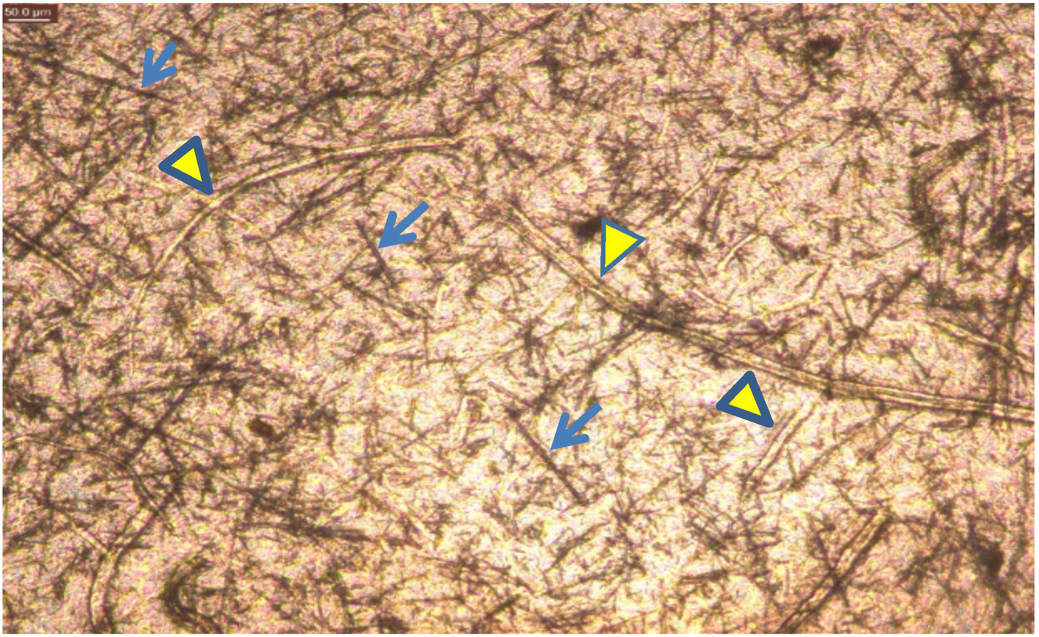 Ijerph 15 00844 g005