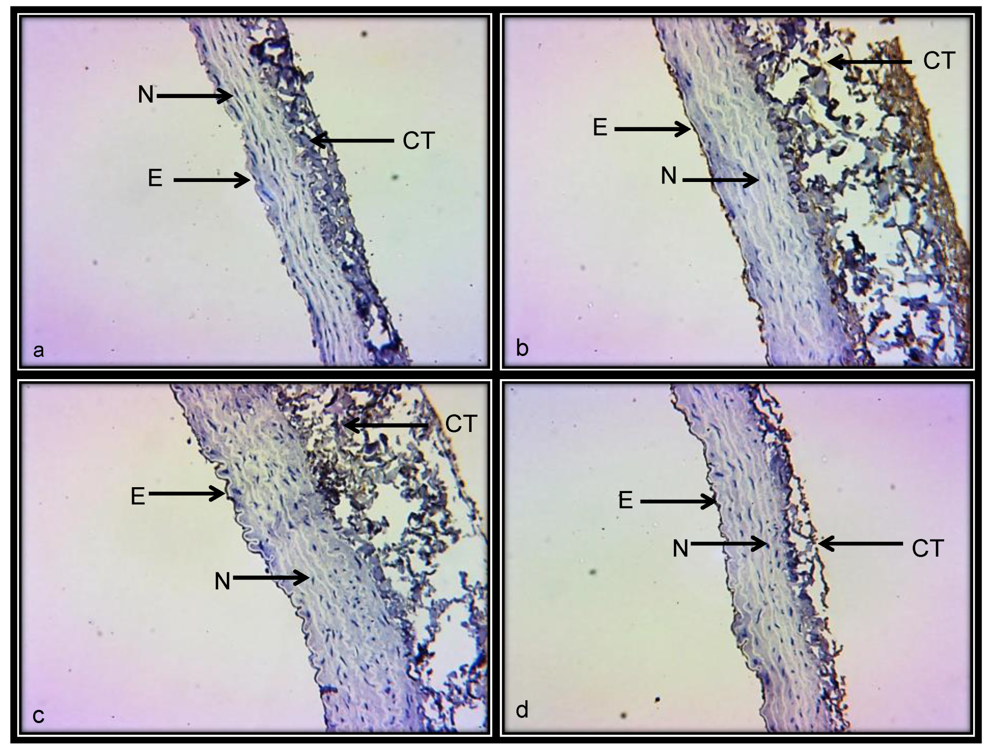 Ijerph 15 01164 g007