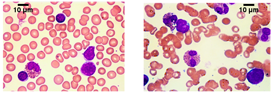 Ijerph 15 01169 g001