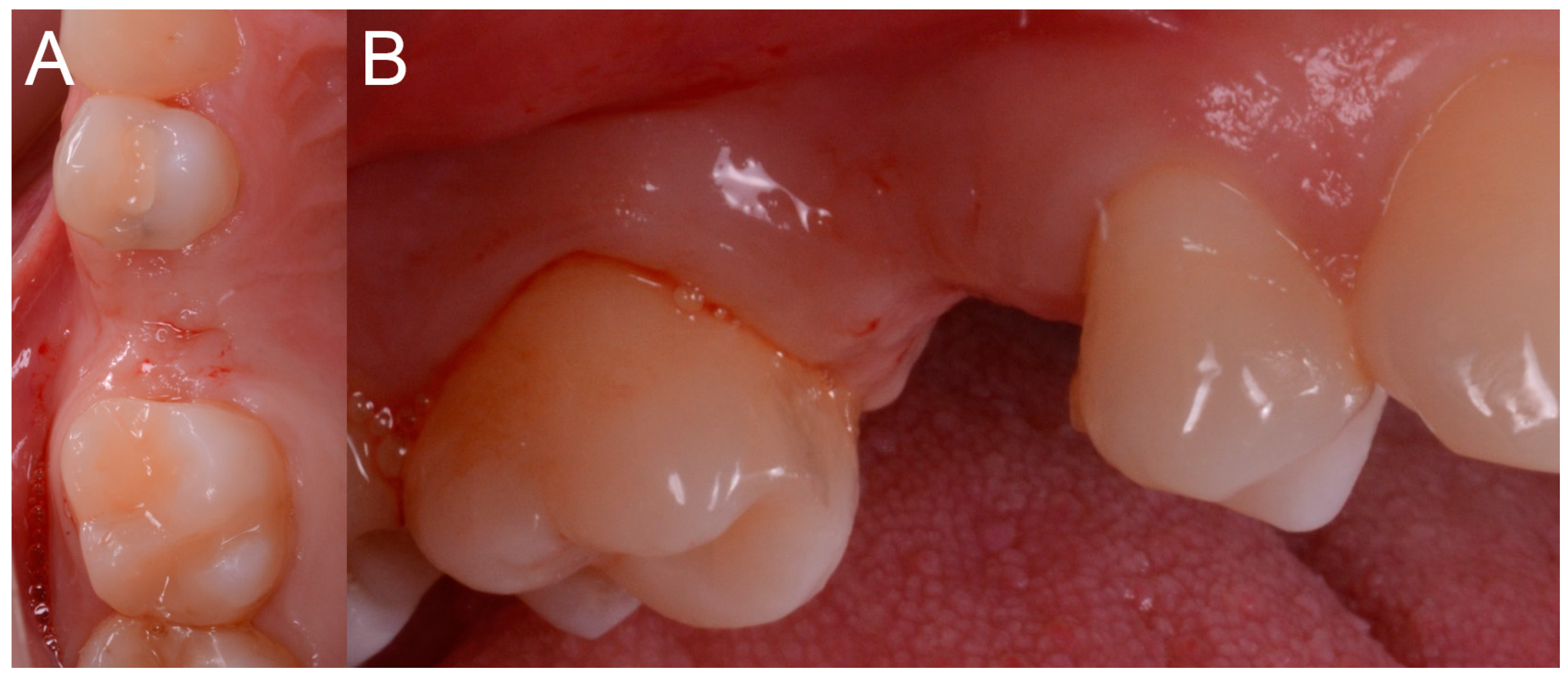 Ijerph 15 02361 g006