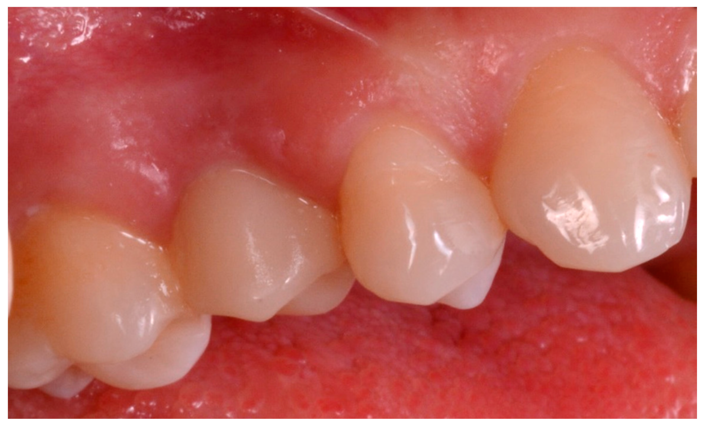 Ijerph 15 02361 g014