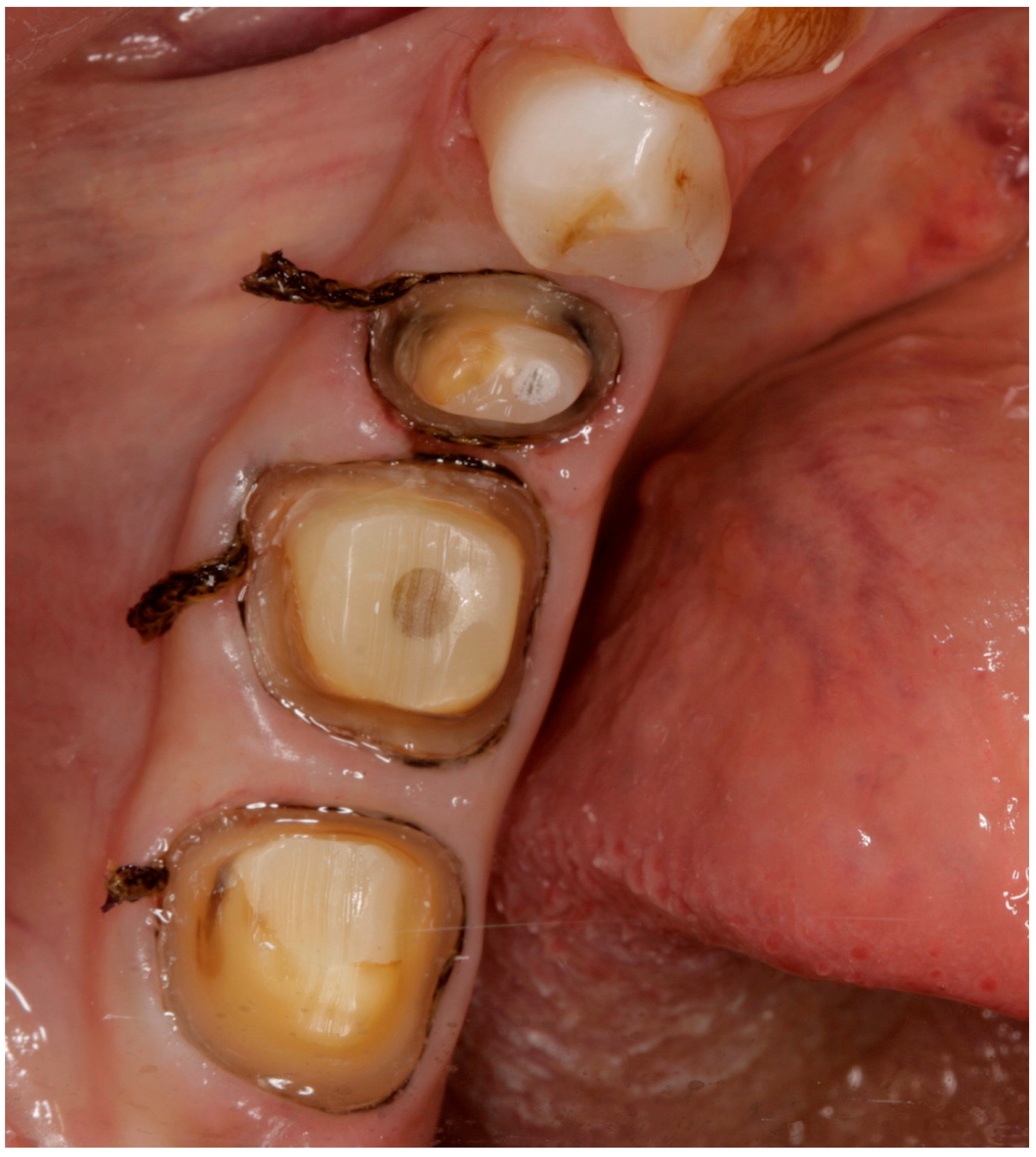 Ijerph 15 02523 g001