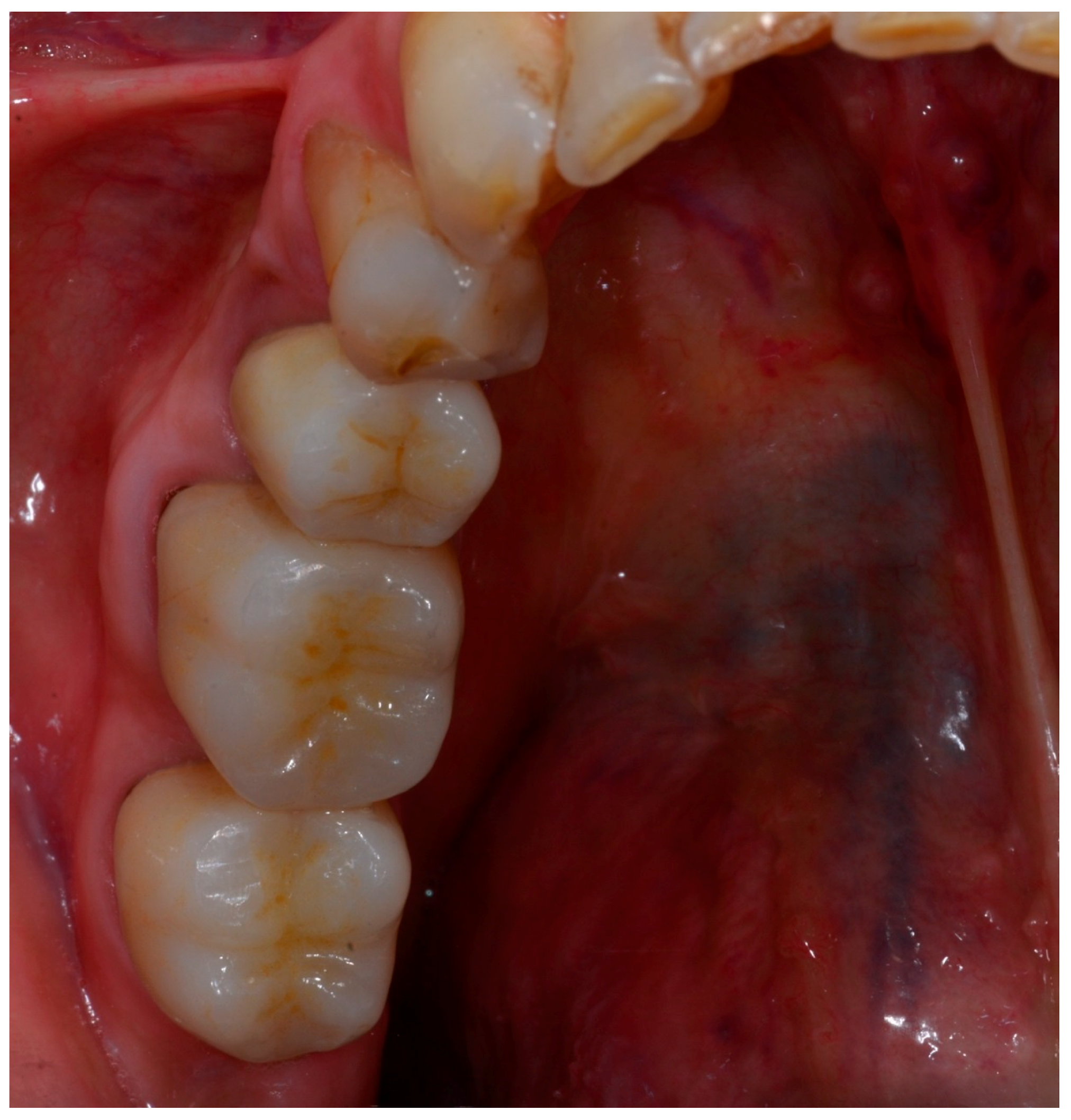 Ijerph 15 02523 g003