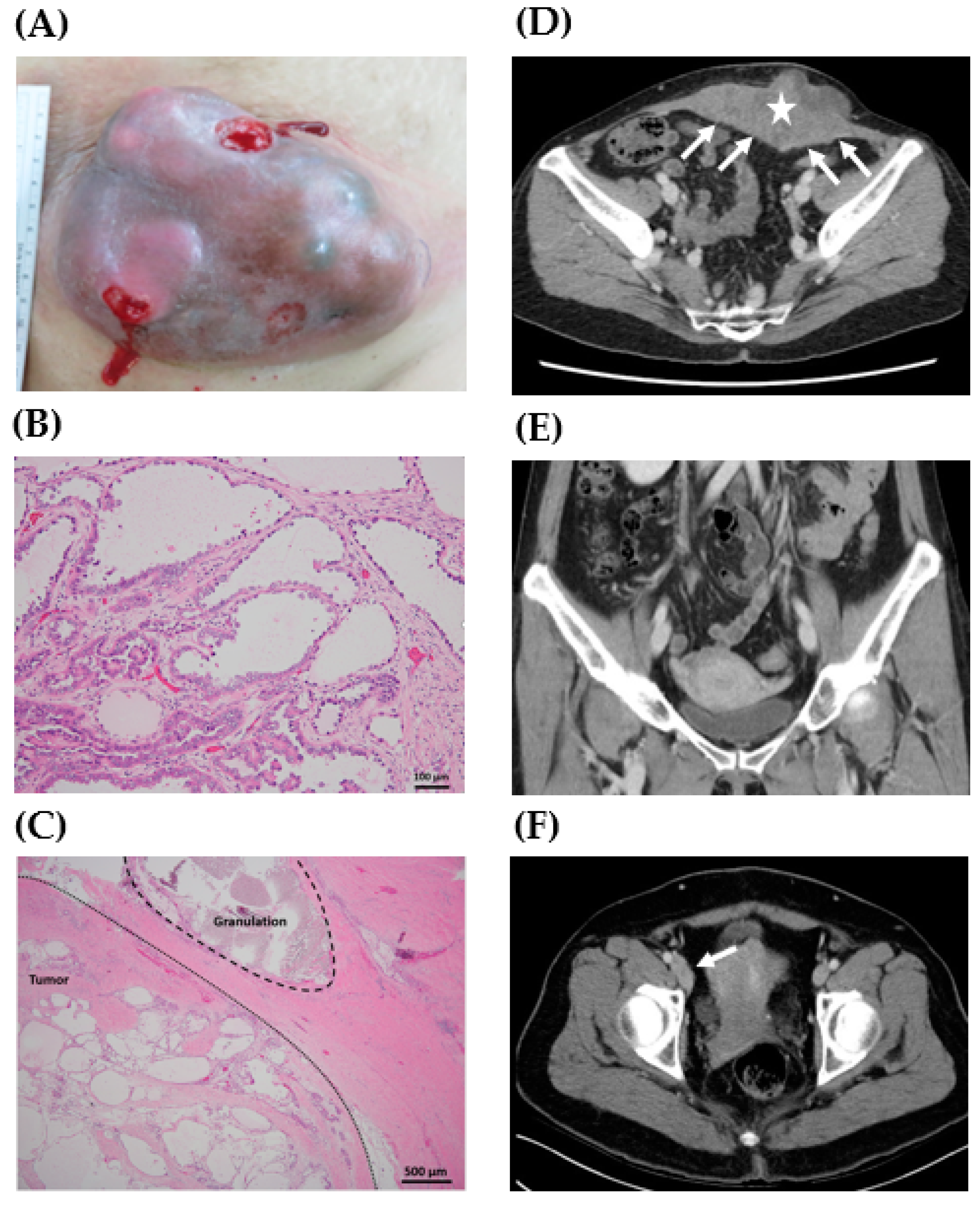 Ijerph 16 00552 g001