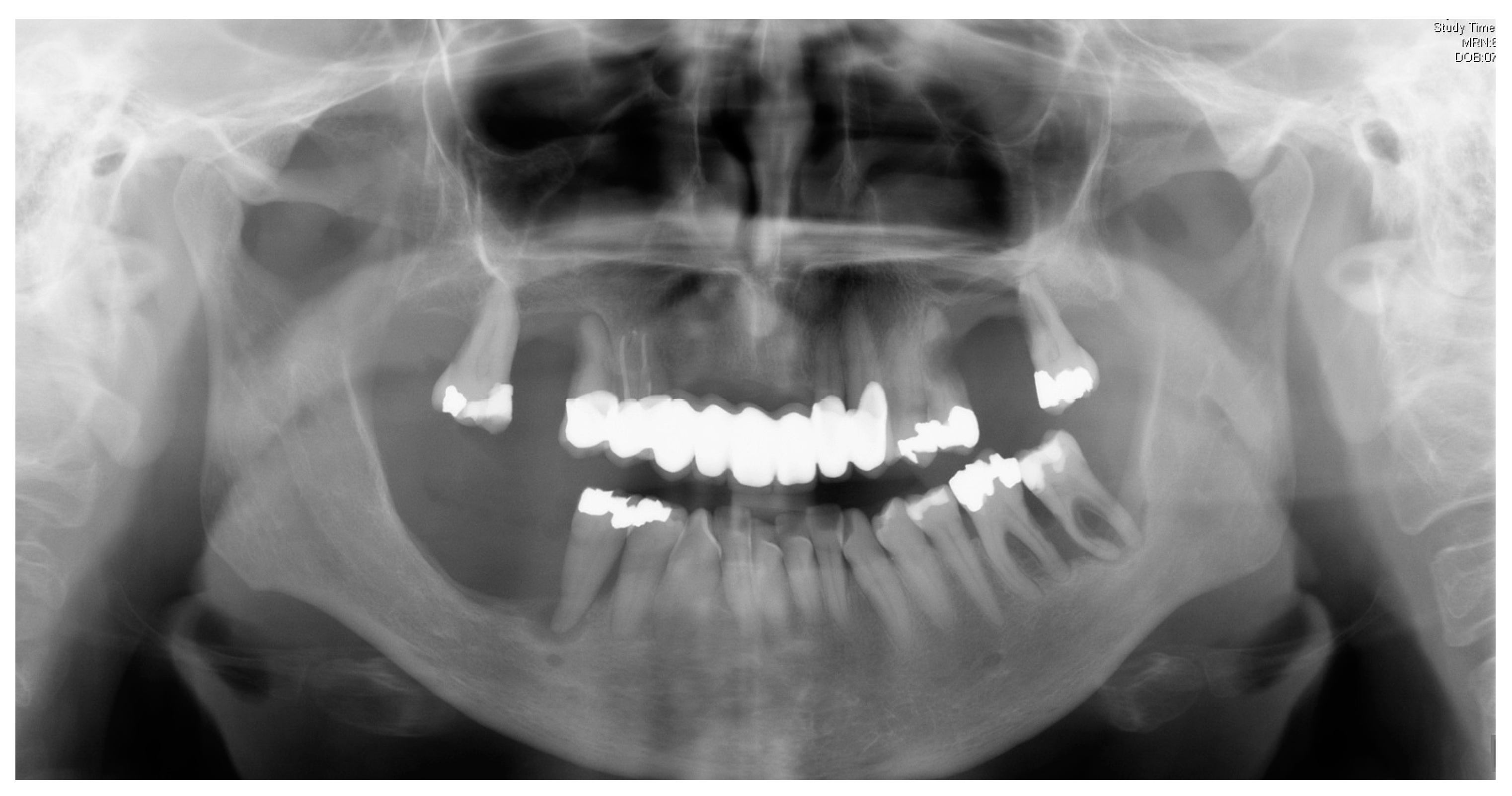 Ijerph 16 00867 g002