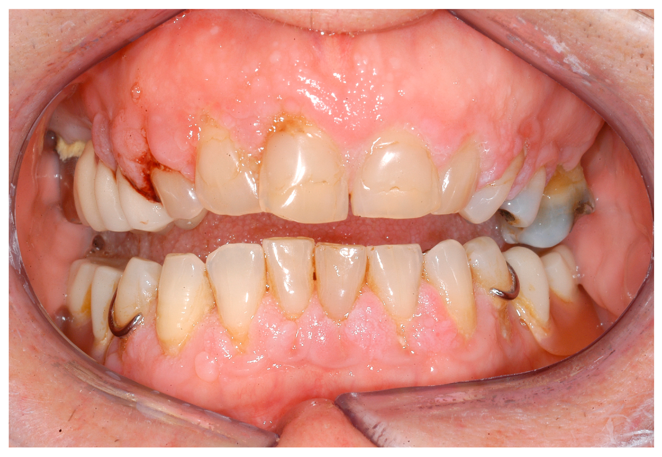 Ijerph 16 00867 g004