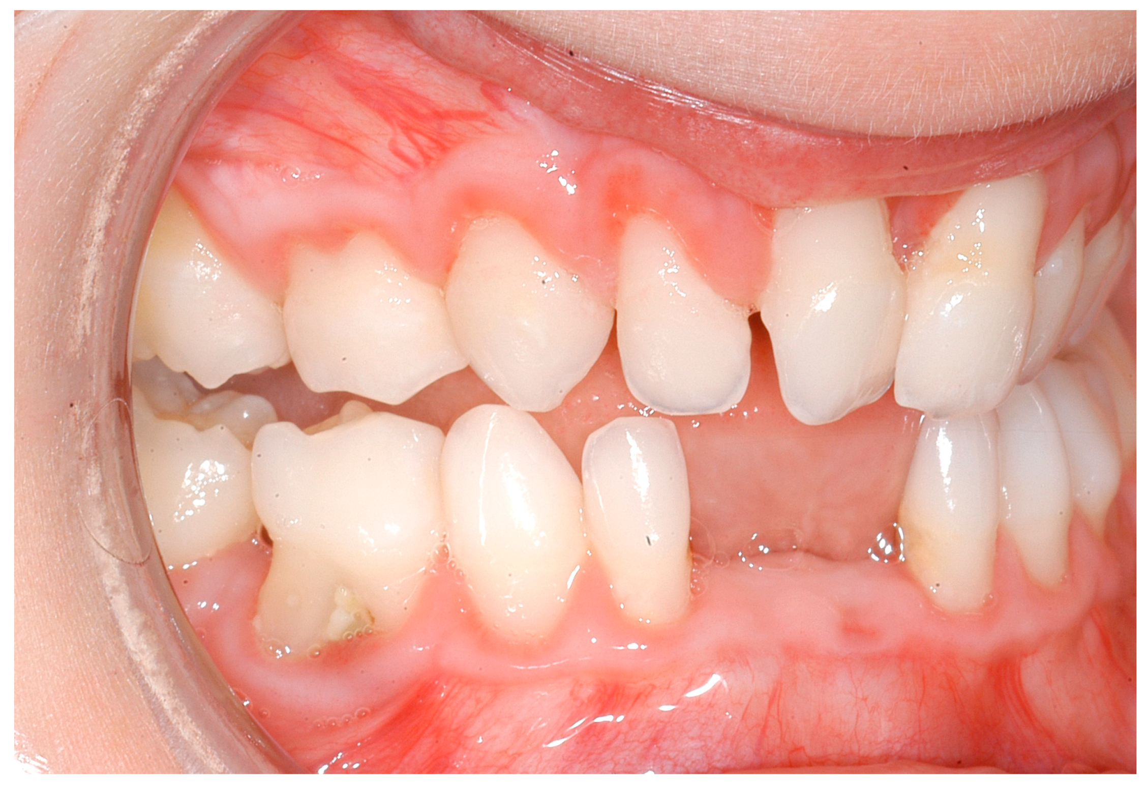 Ijerph 16 00867 g006