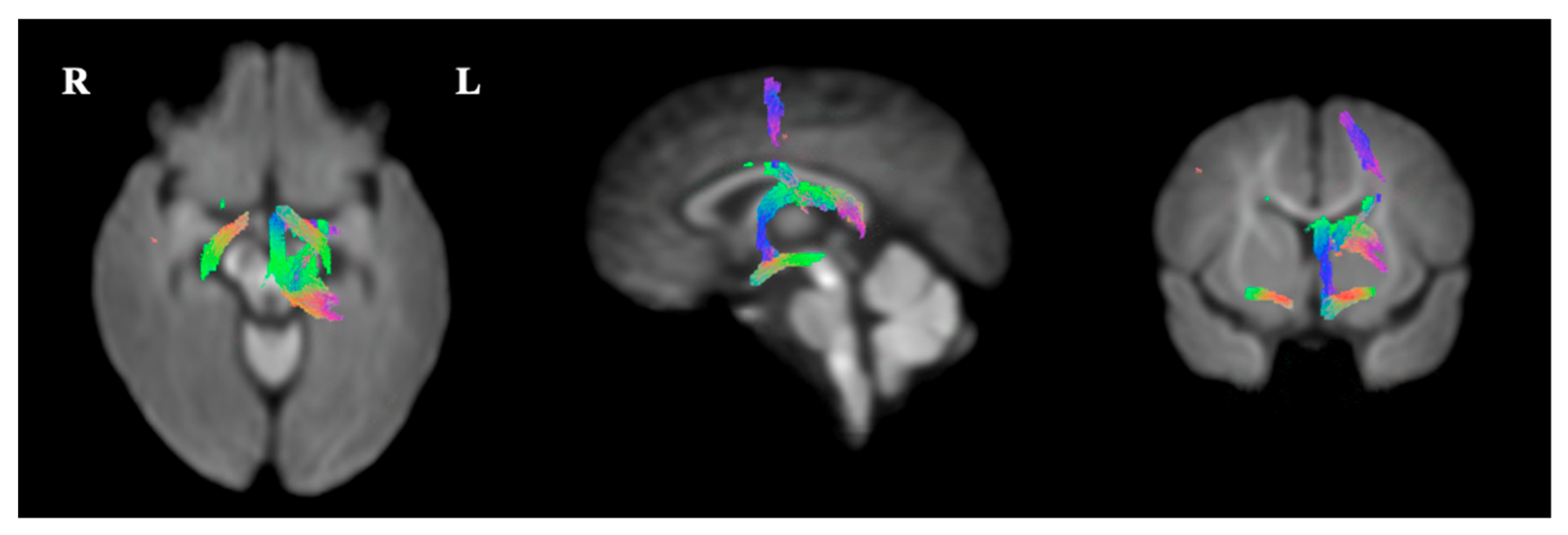 Ijerph 16 01816 g005