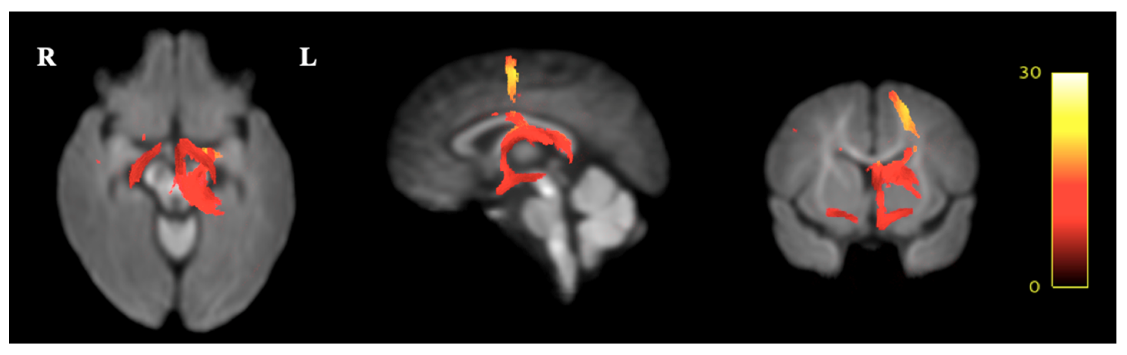 Ijerph 16 01816 g006