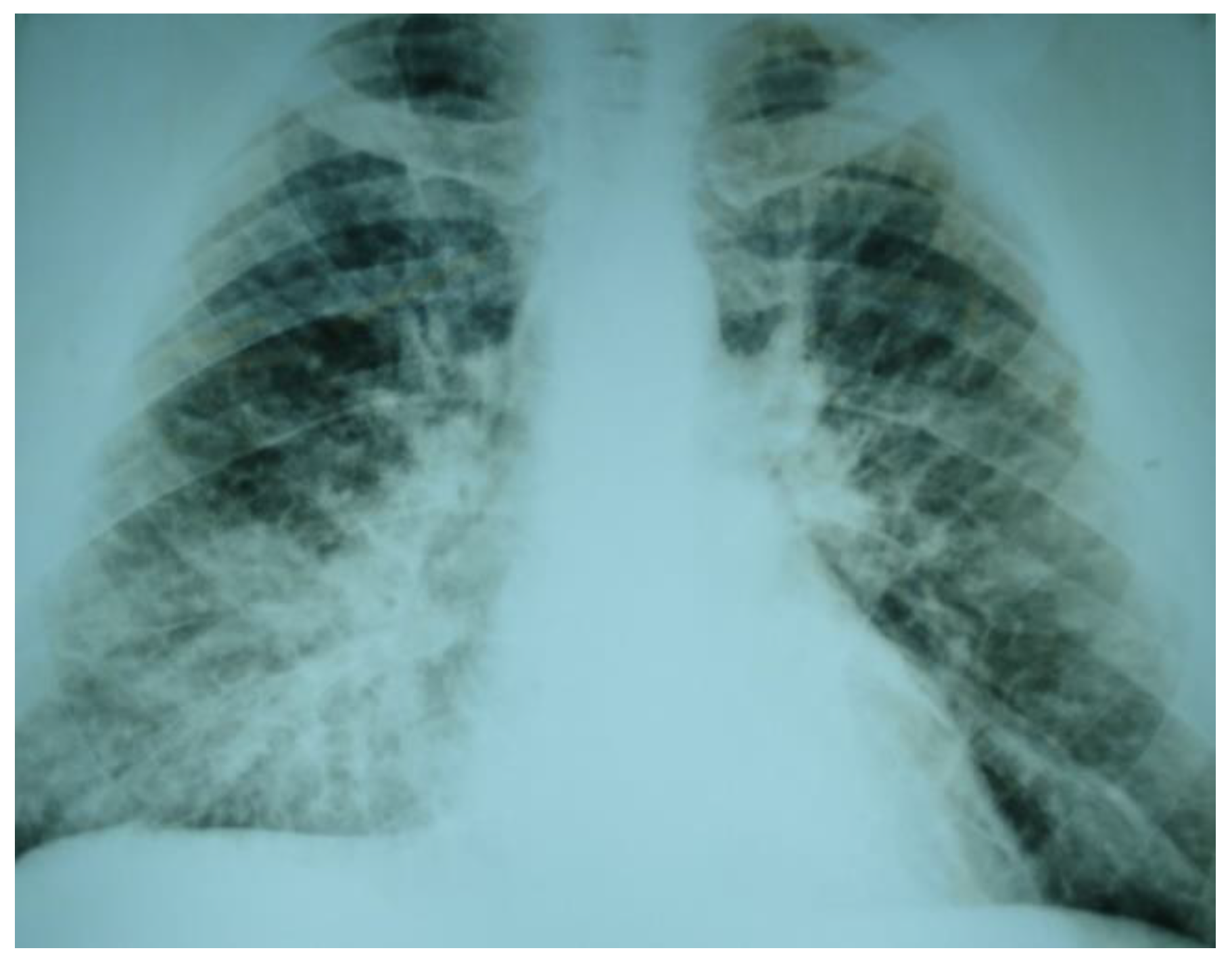 Ijerph 16 01852 g002