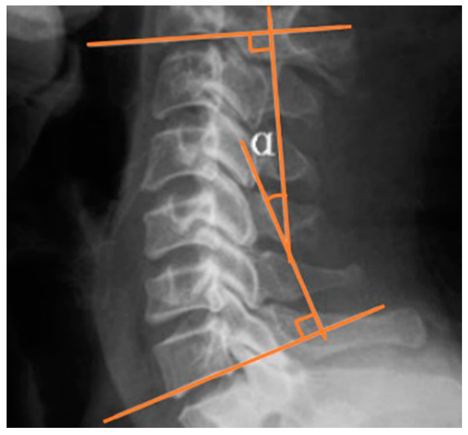 Ijerph 16 02162 g002 Ijerph 16 02162 g002