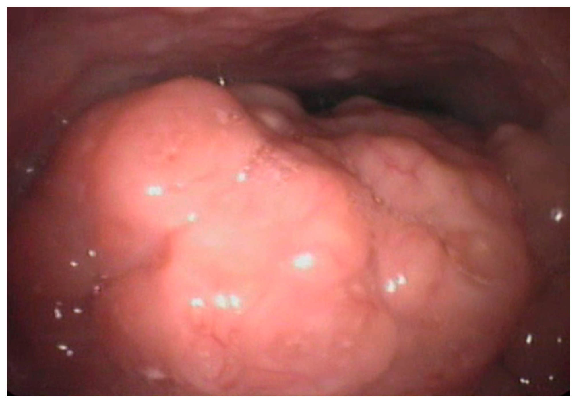 Ijerph 16 03235 g002 Ijerph 16 03235 g002