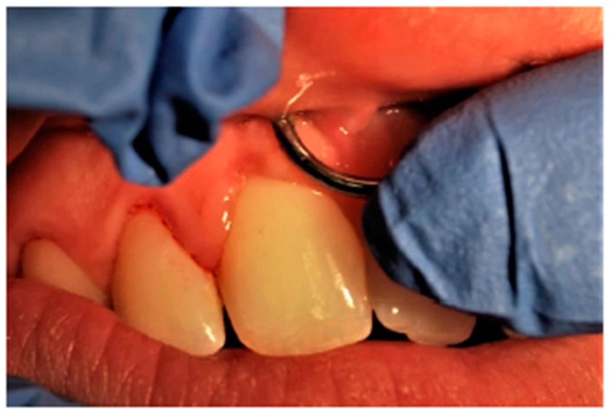 Ijerph 17 00613 g001