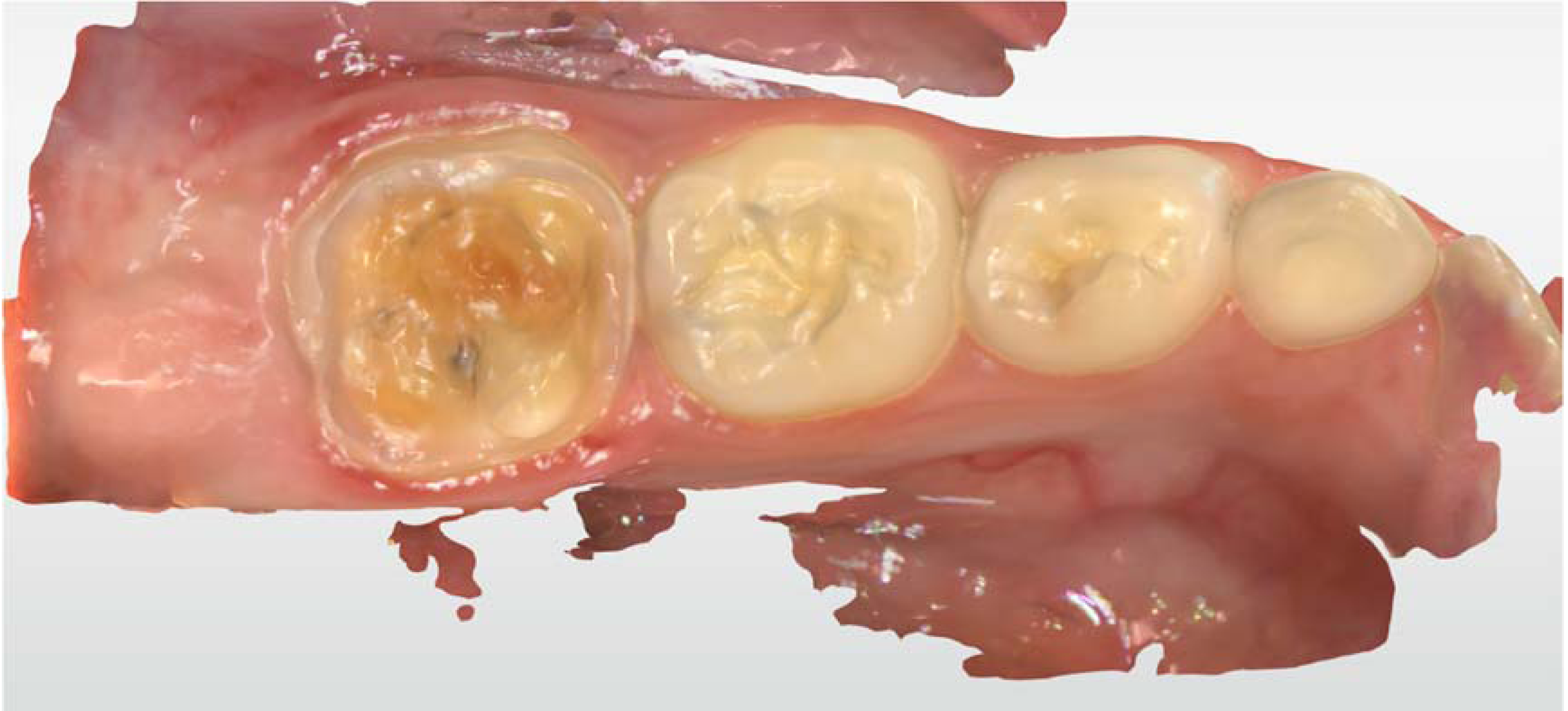 Ijerph 17 01499 g003