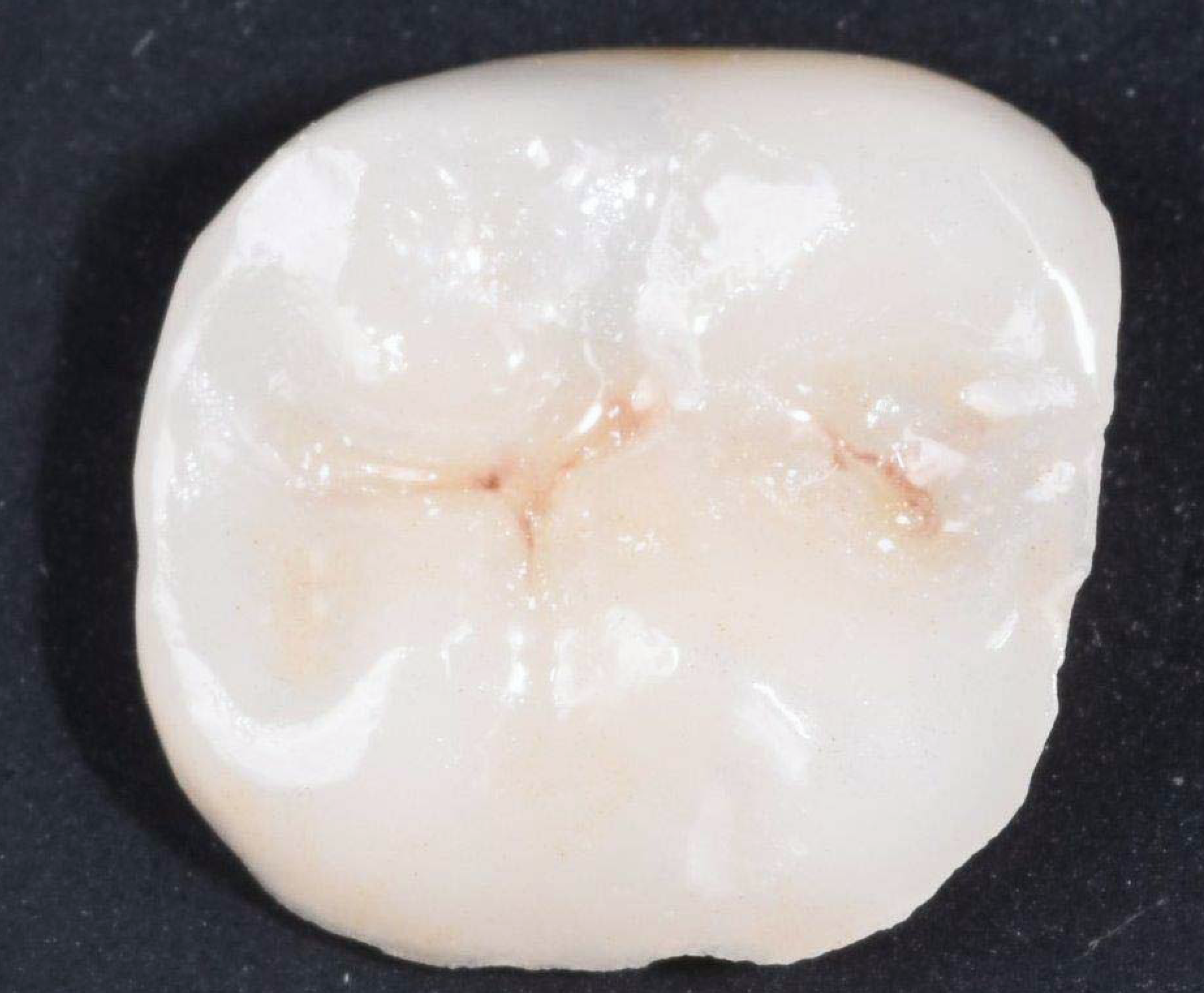 Ijerph 17 01499 g004