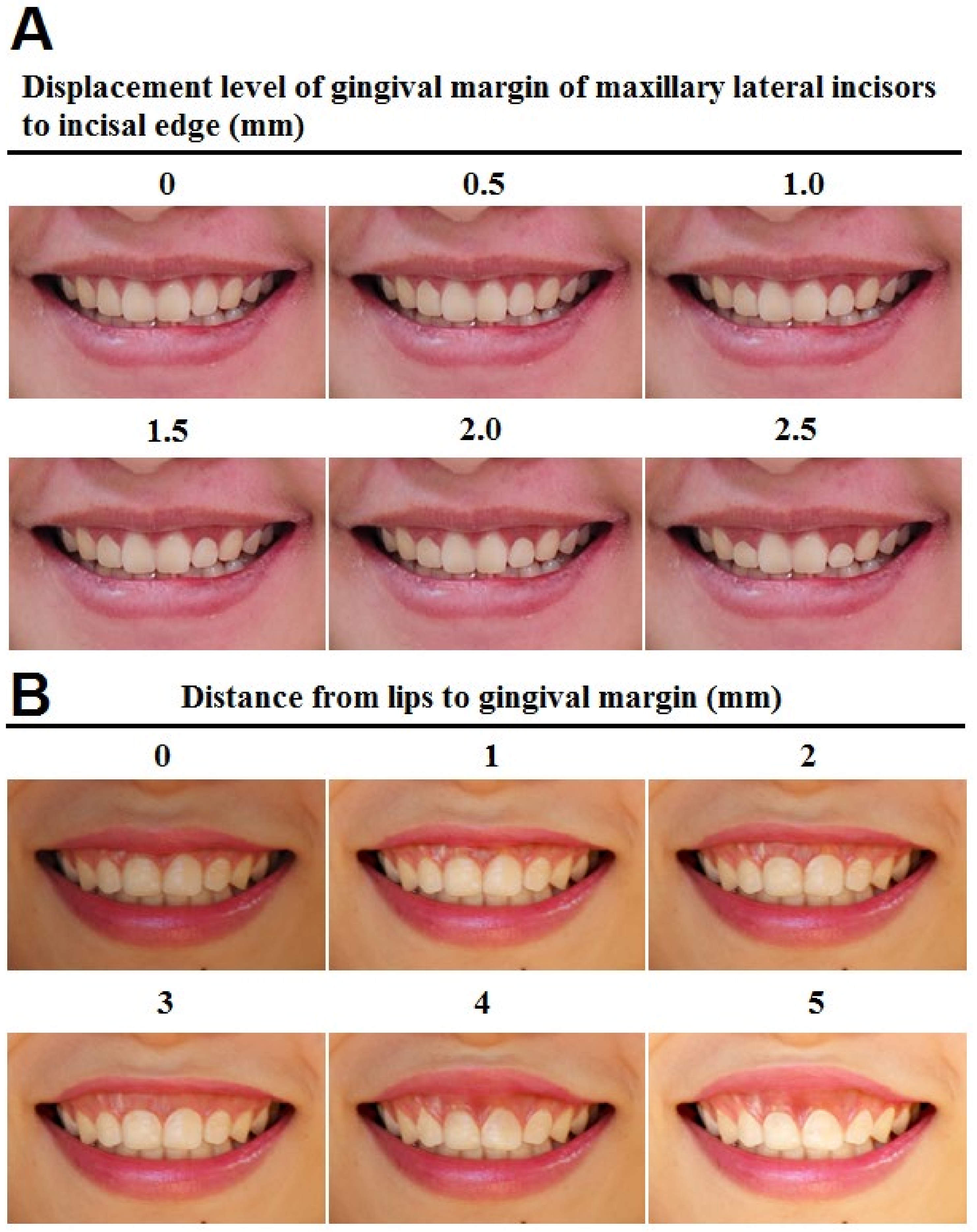 Ijerph 17 01638 g002