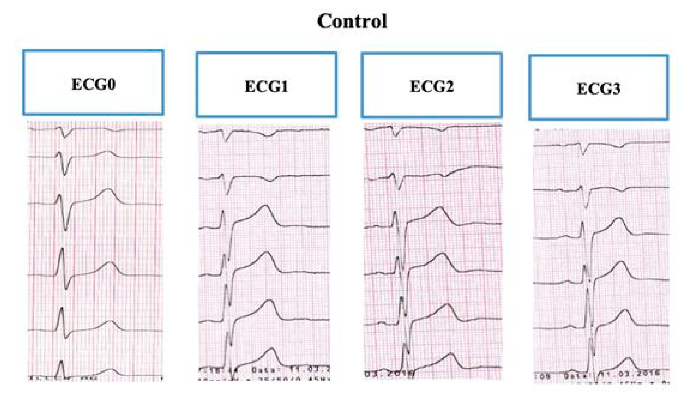 Ijerph 17 01908 g003