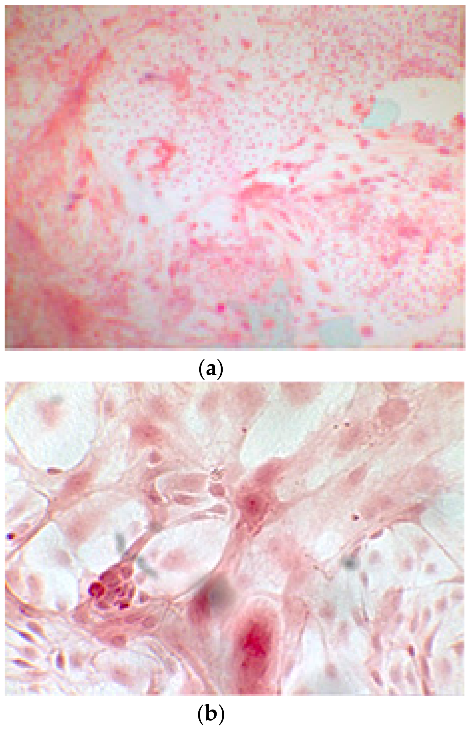 Ijerph 17 01947 g006a Ijerph 17 01947 g006a