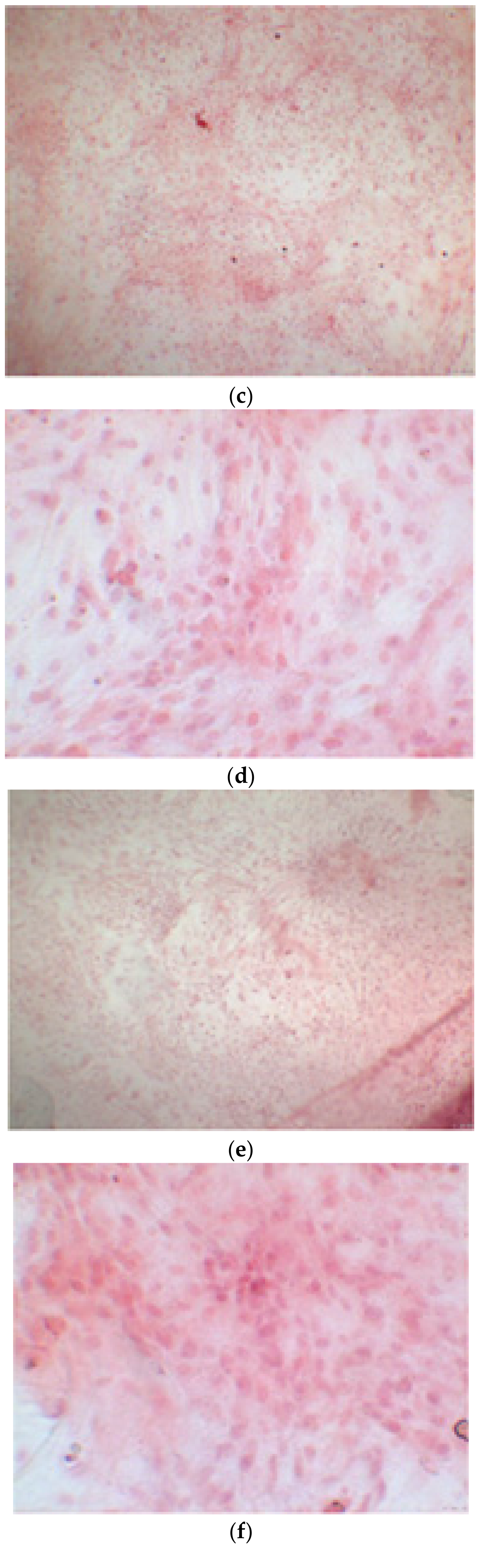 Ijerph 17 01947 g009b Ijerph 17 01947 g009b