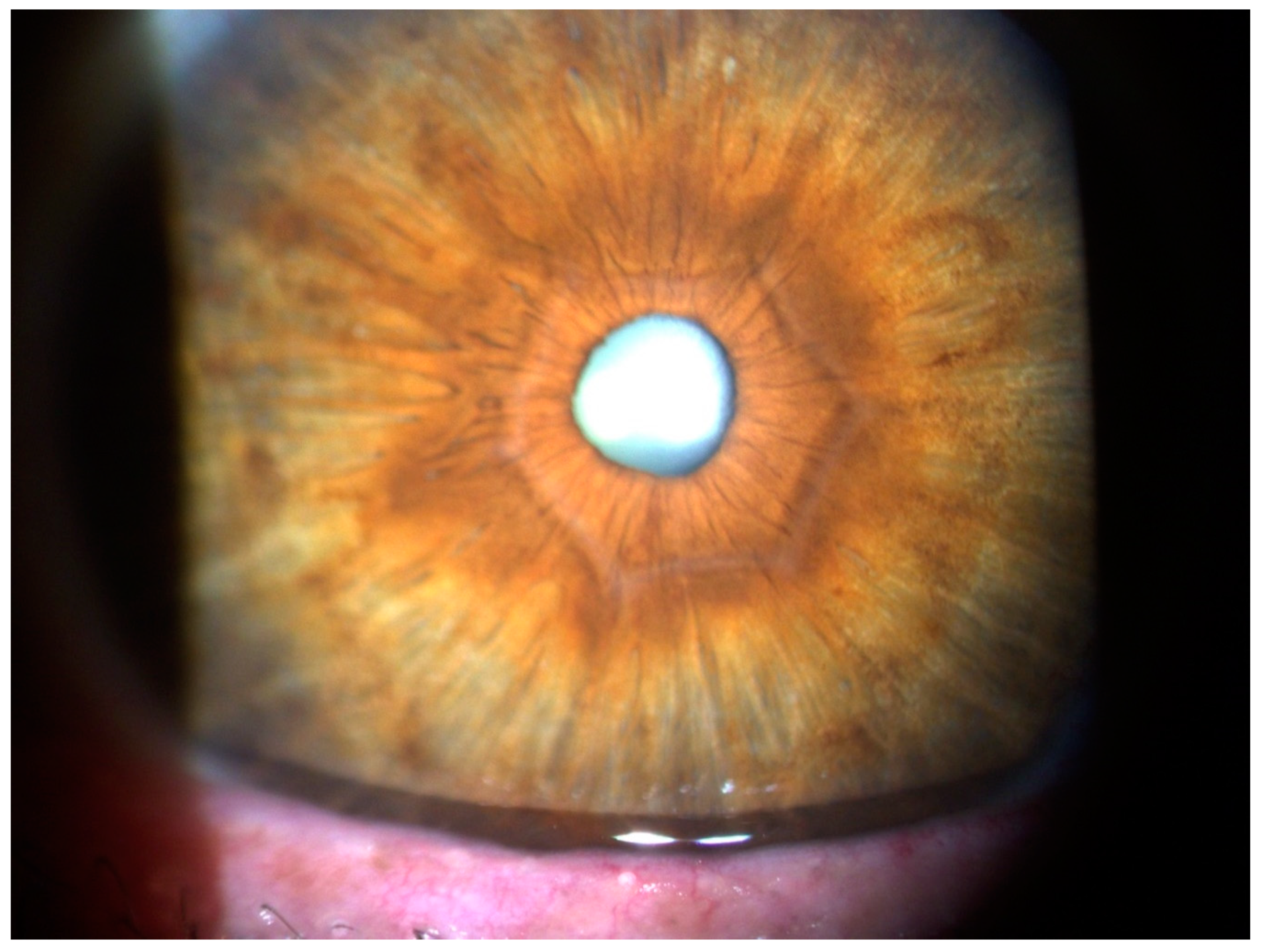 Ijerph 17 02113 g011