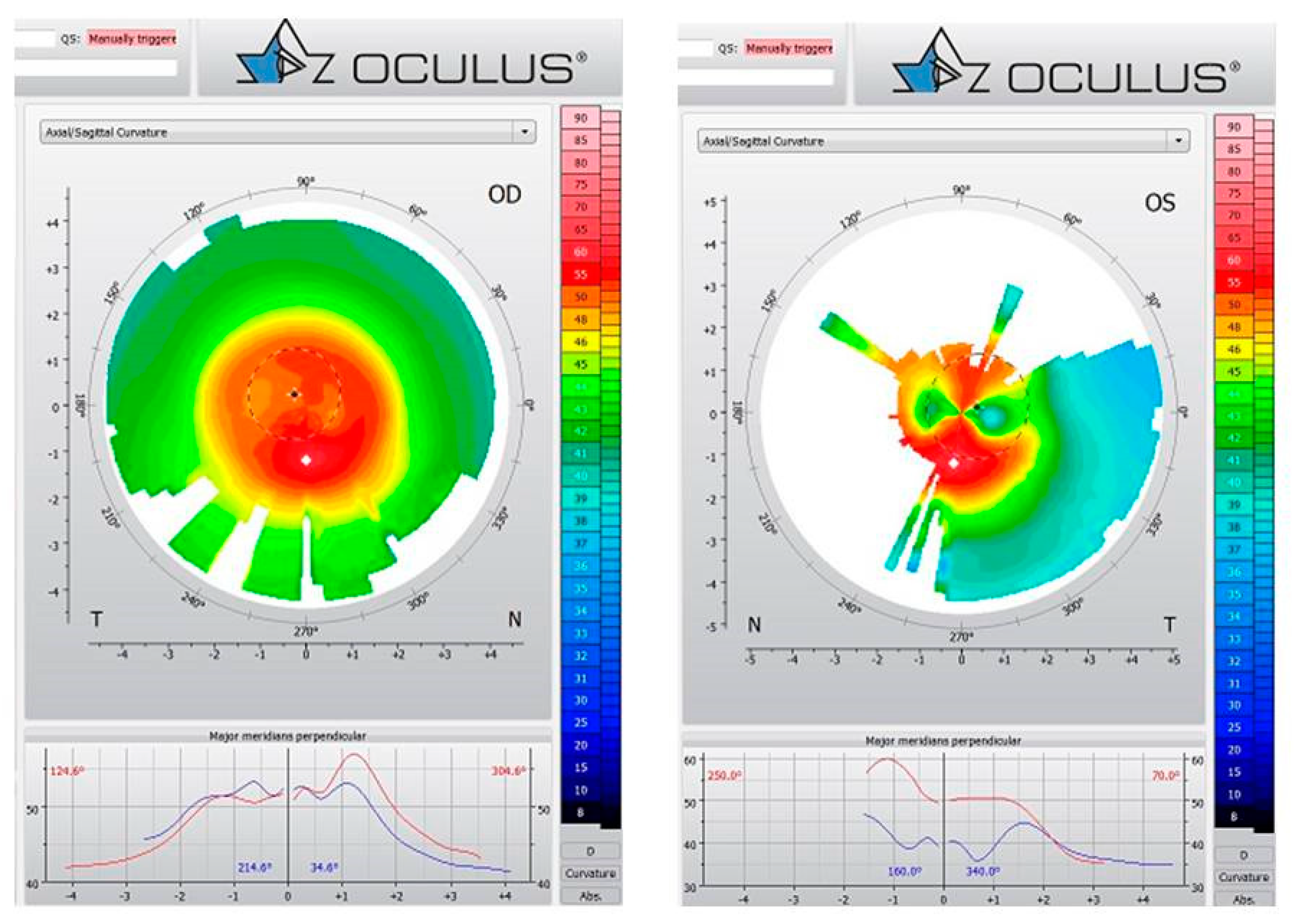 Ijerph 17 02113 g012