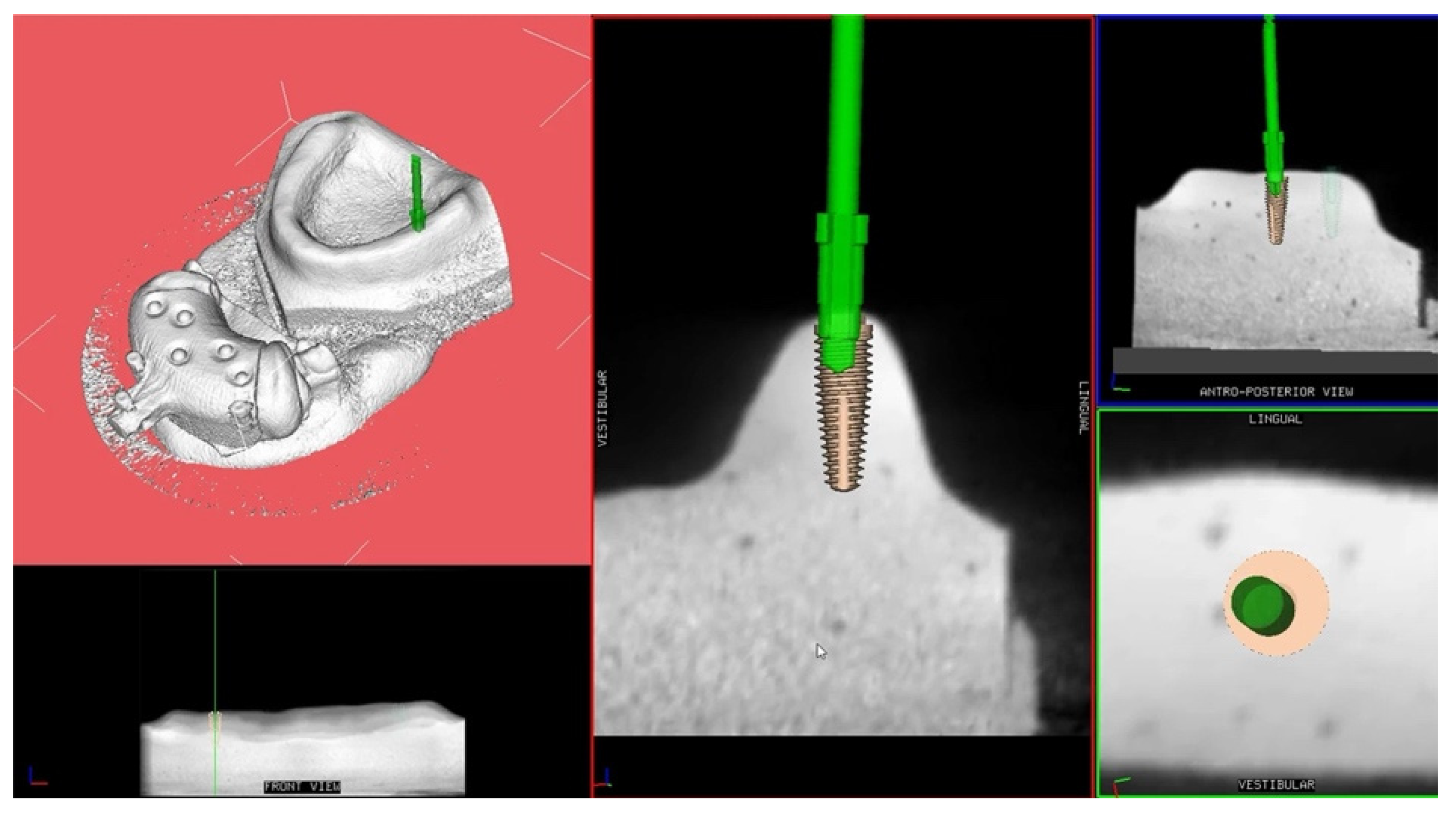 Ijerph 17 02153 g003 Ijerph 17 02153 g003