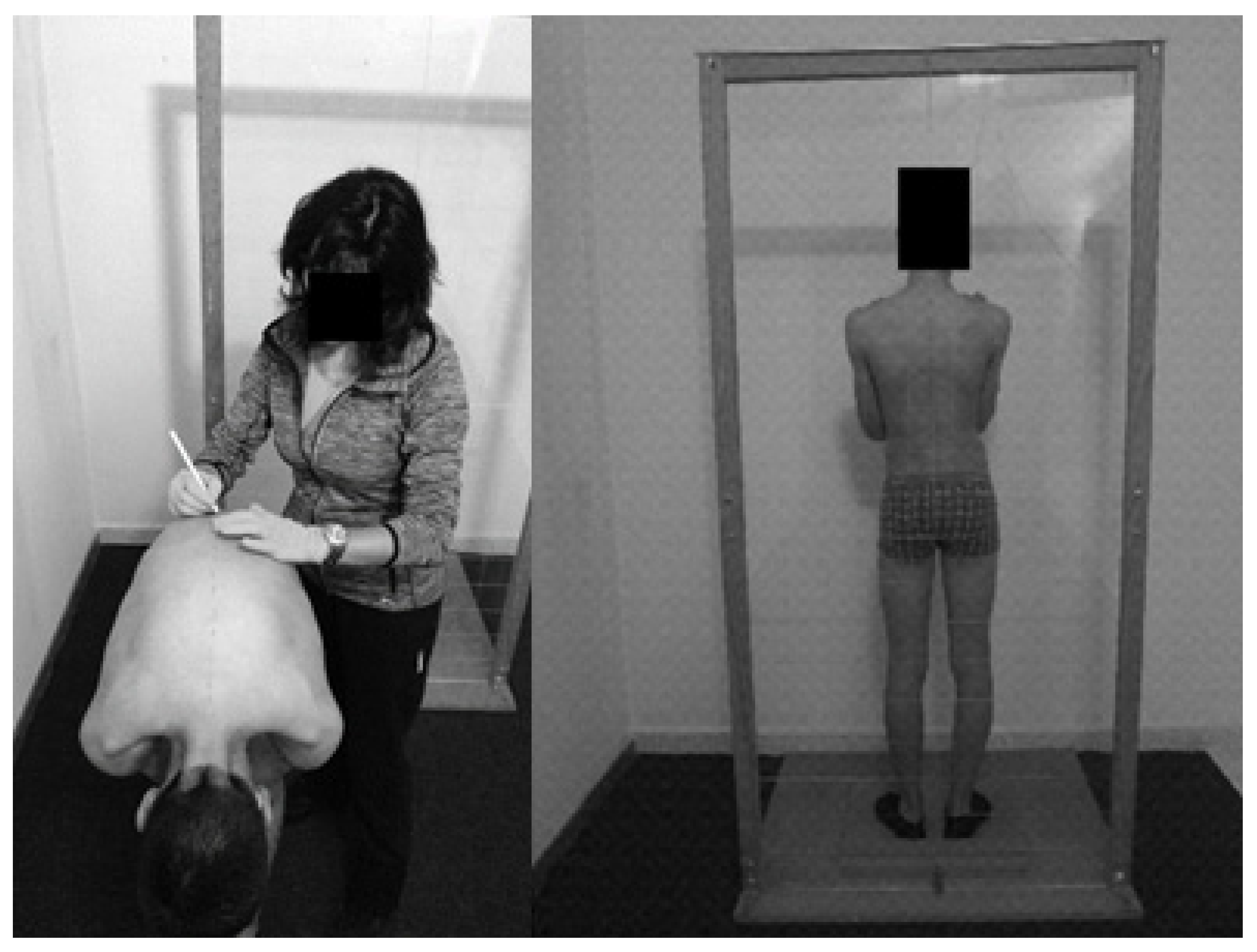 Ijerph 17 02915 g001