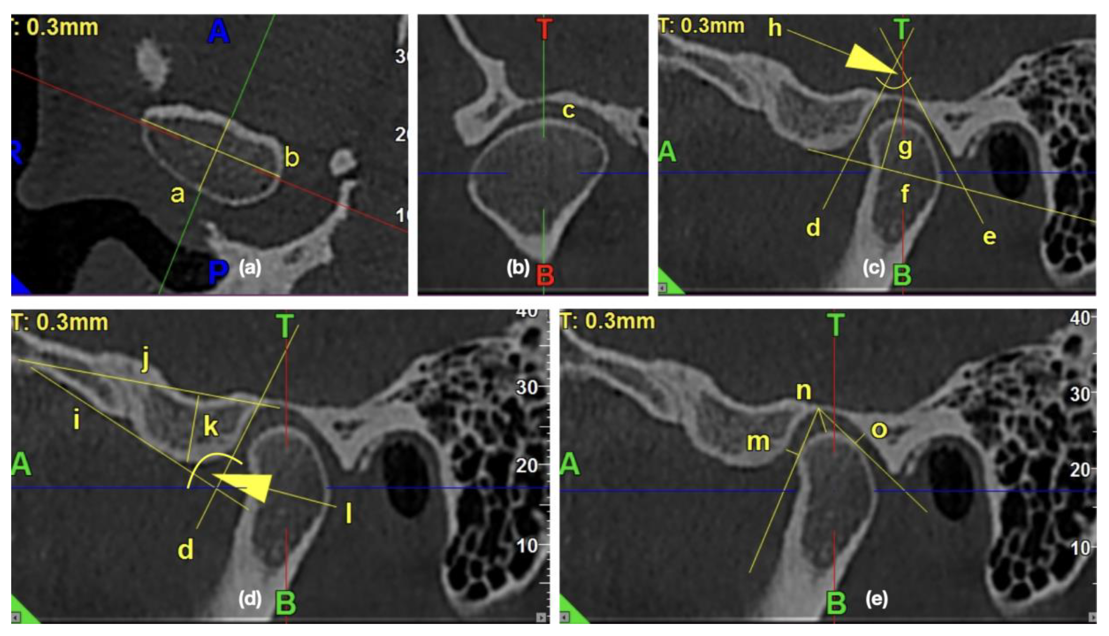 Ijerph 17 02923 g002 Ijerph 17 02923 g002