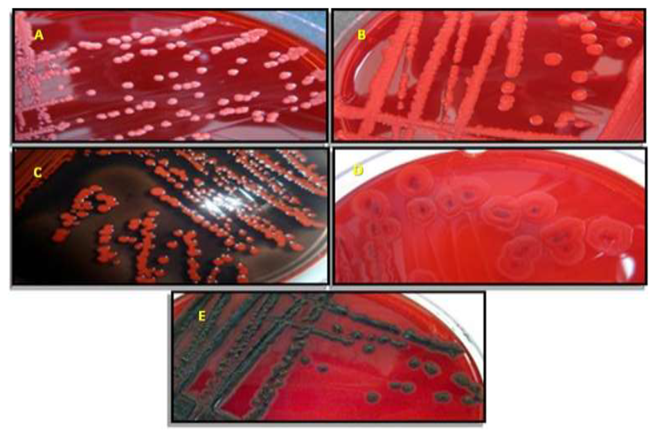 Ijerph 17 03761 g002