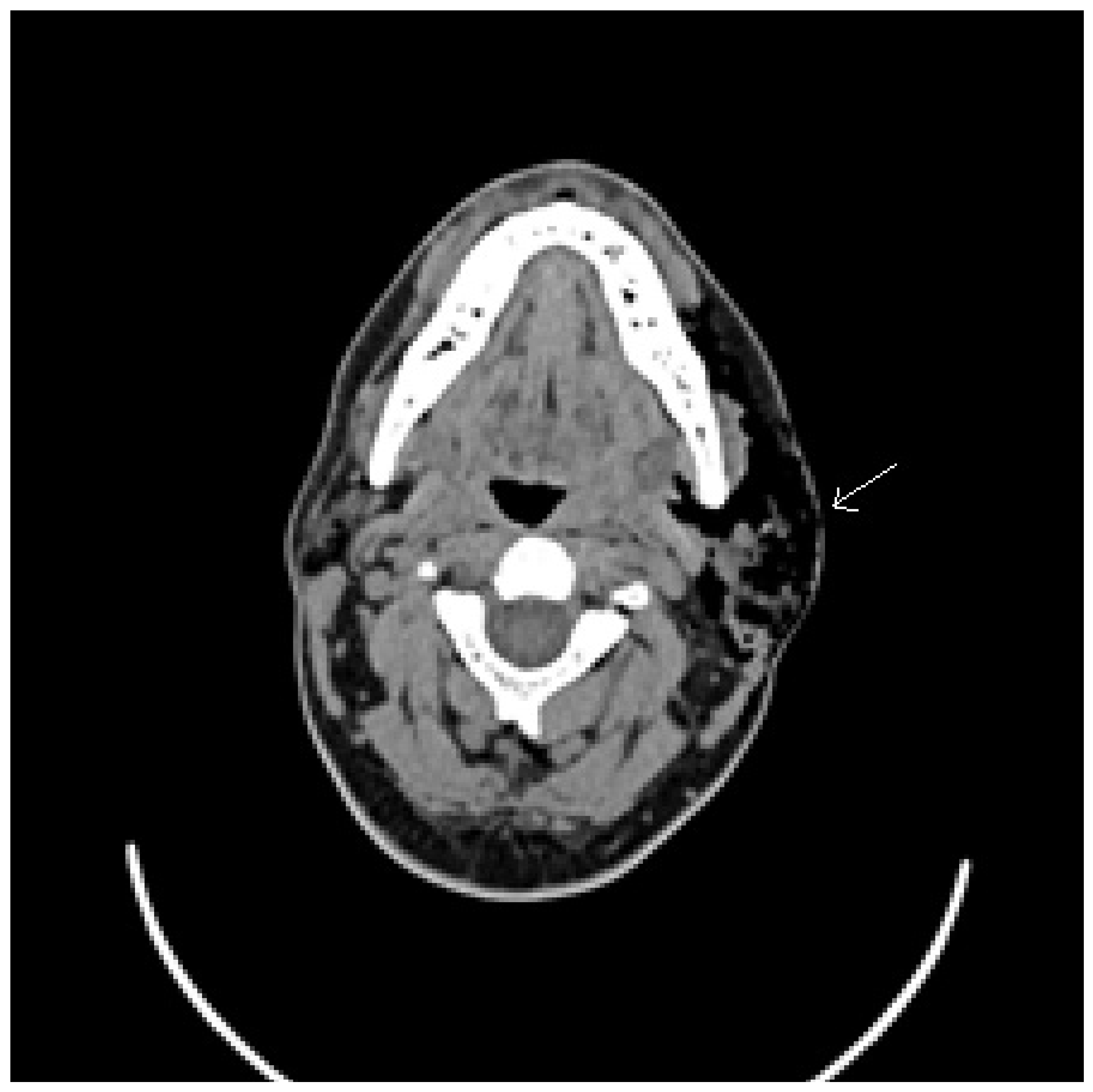 Ijerph 17 03936 g001 Ijerph 17 03936 g001