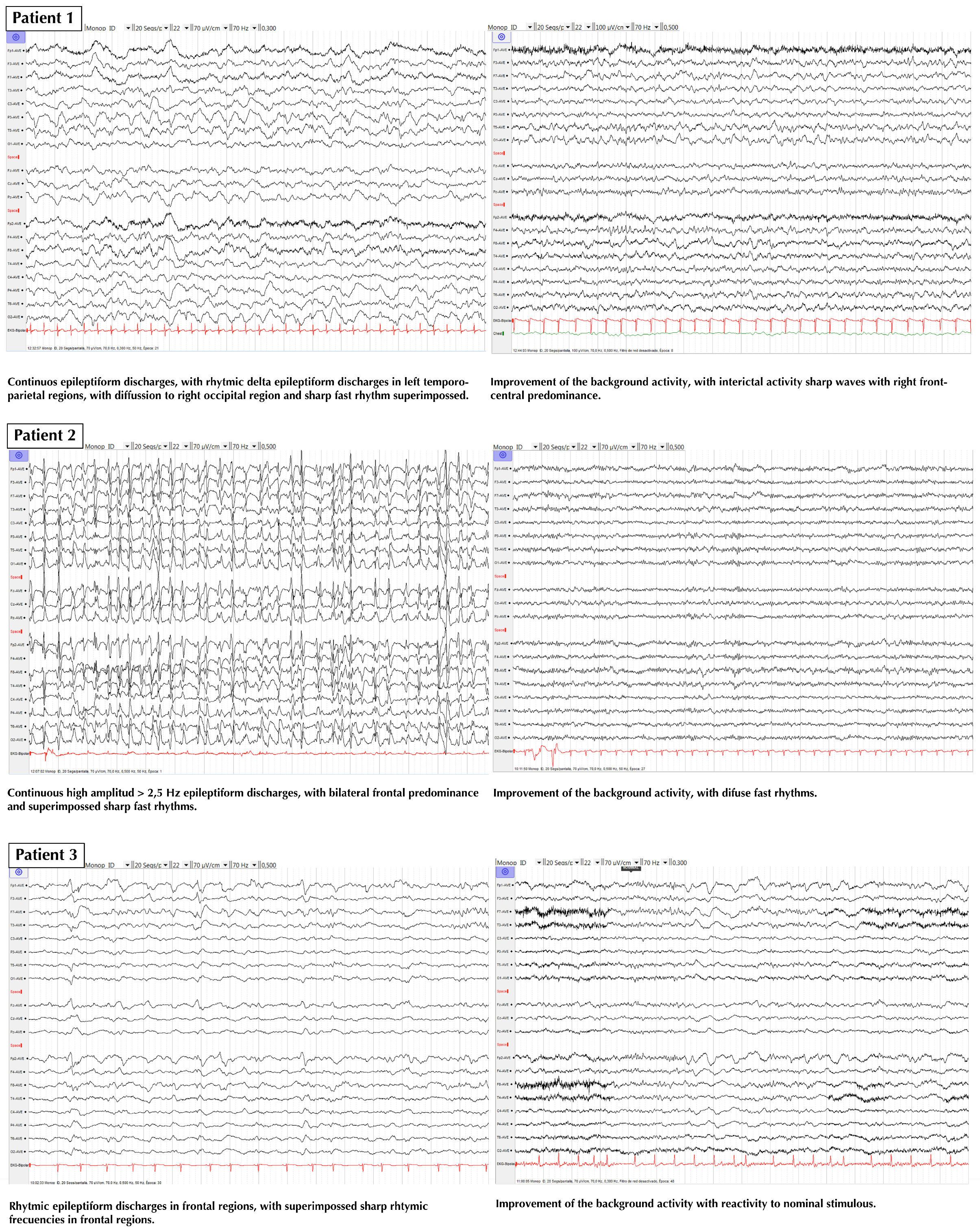 Ijerph 17 04023 g002a Ijerph 17 04023 g002a