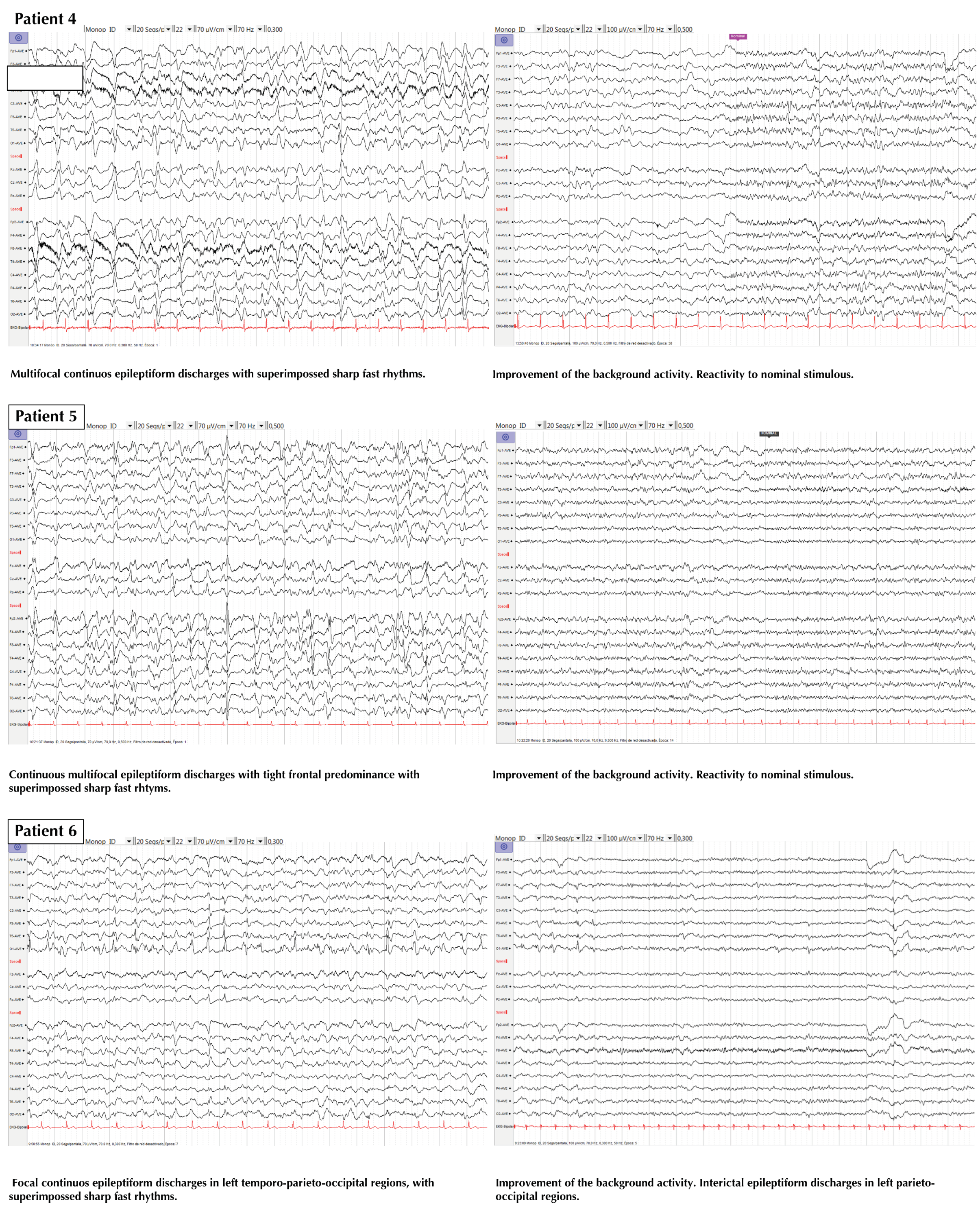 Ijerph 17 04023 g002b Ijerph 17 04023 g002b