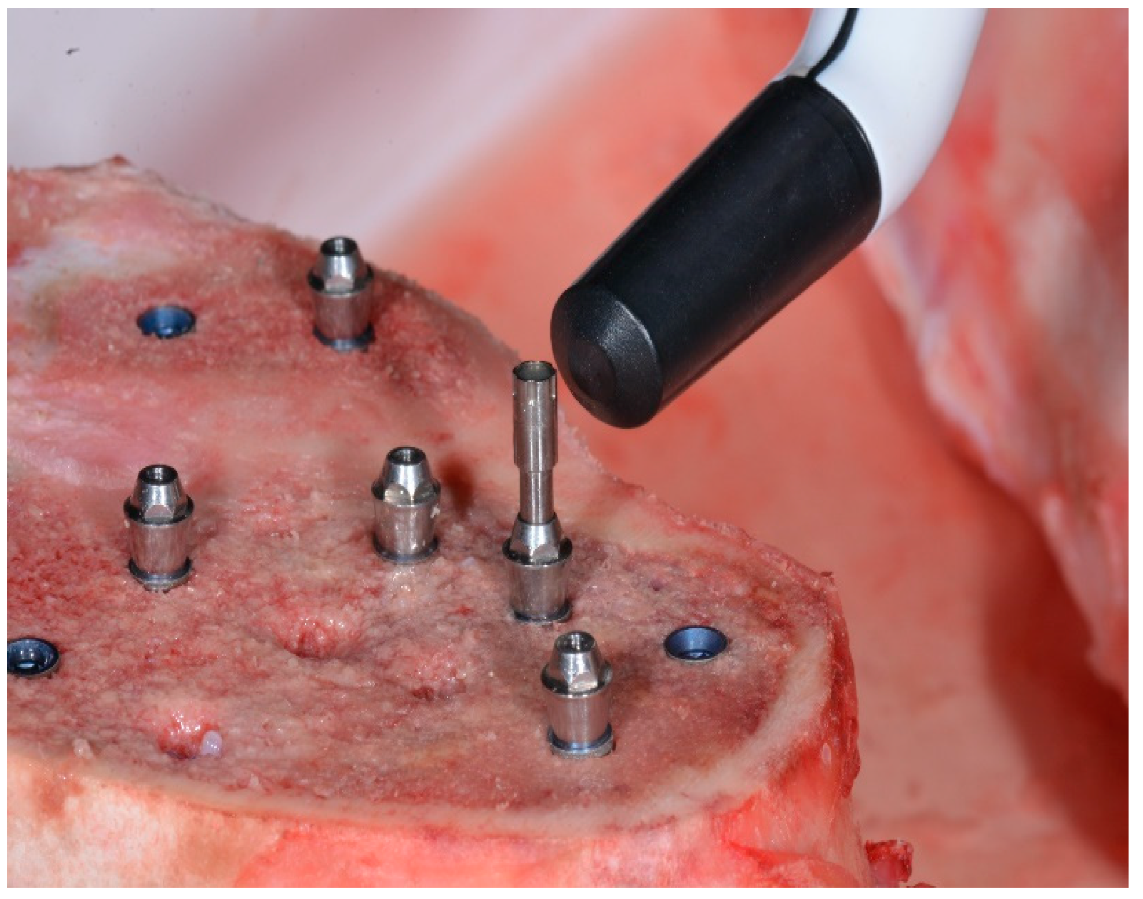 Ijerph 17 04073 g002