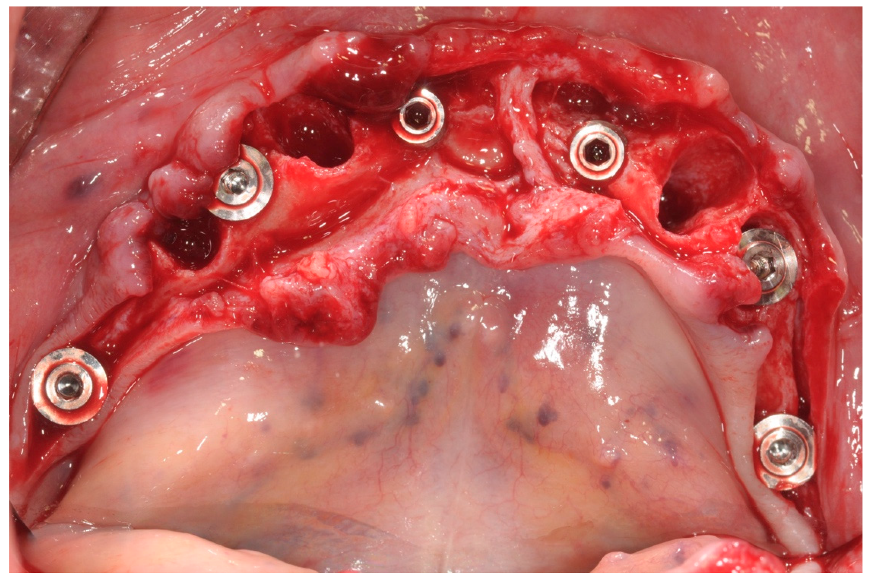 Ijerph 17 04607 g004