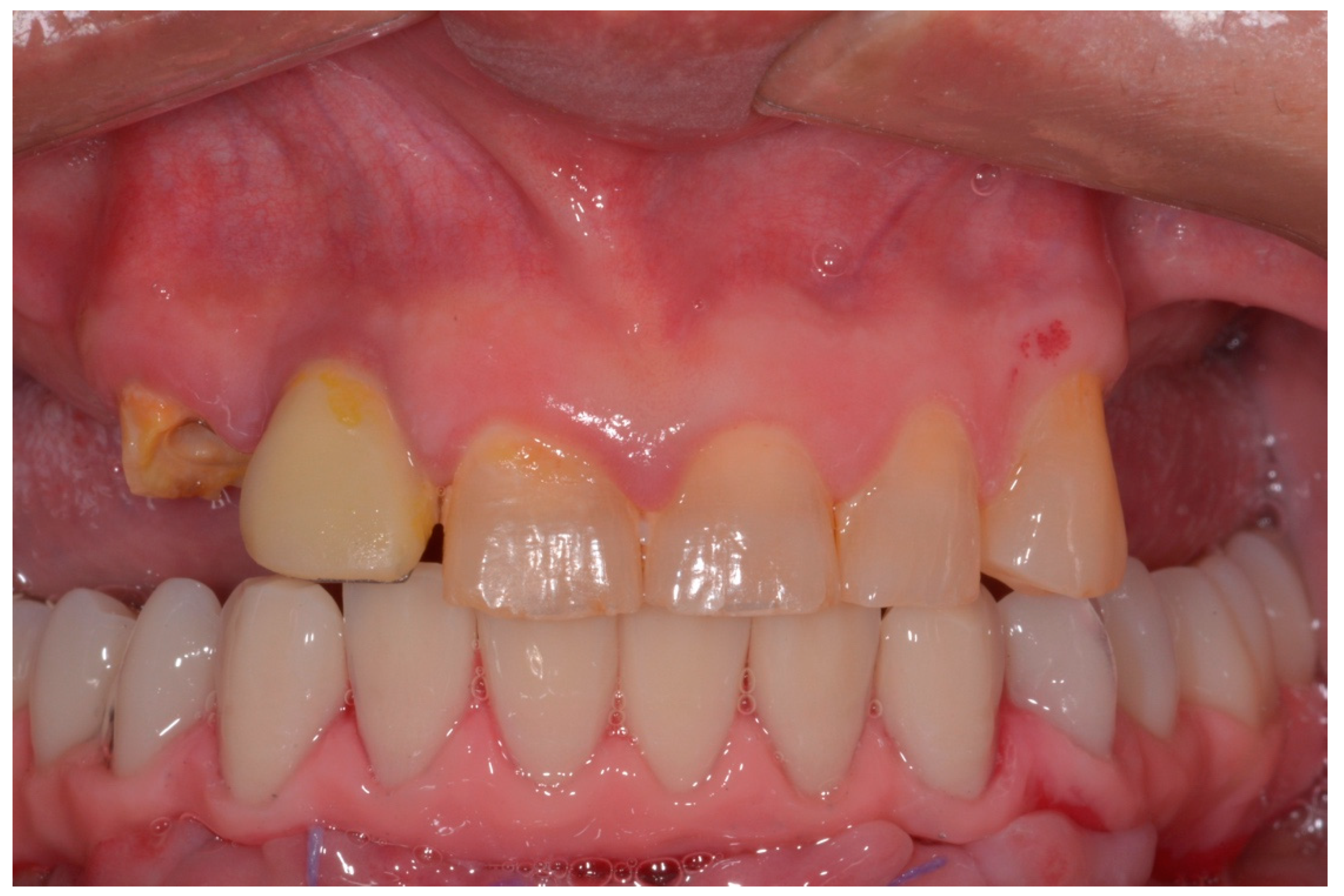 Ijerph 17 04607 g006