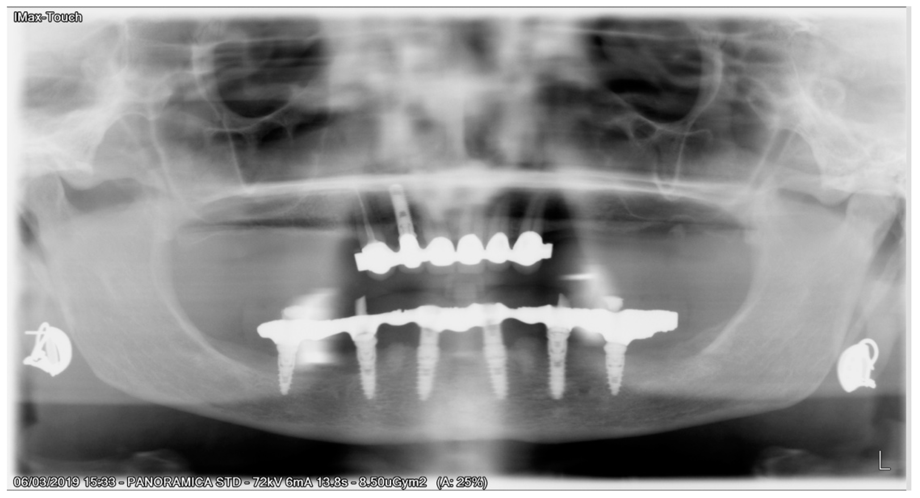 Ijerph 17 04607 g007