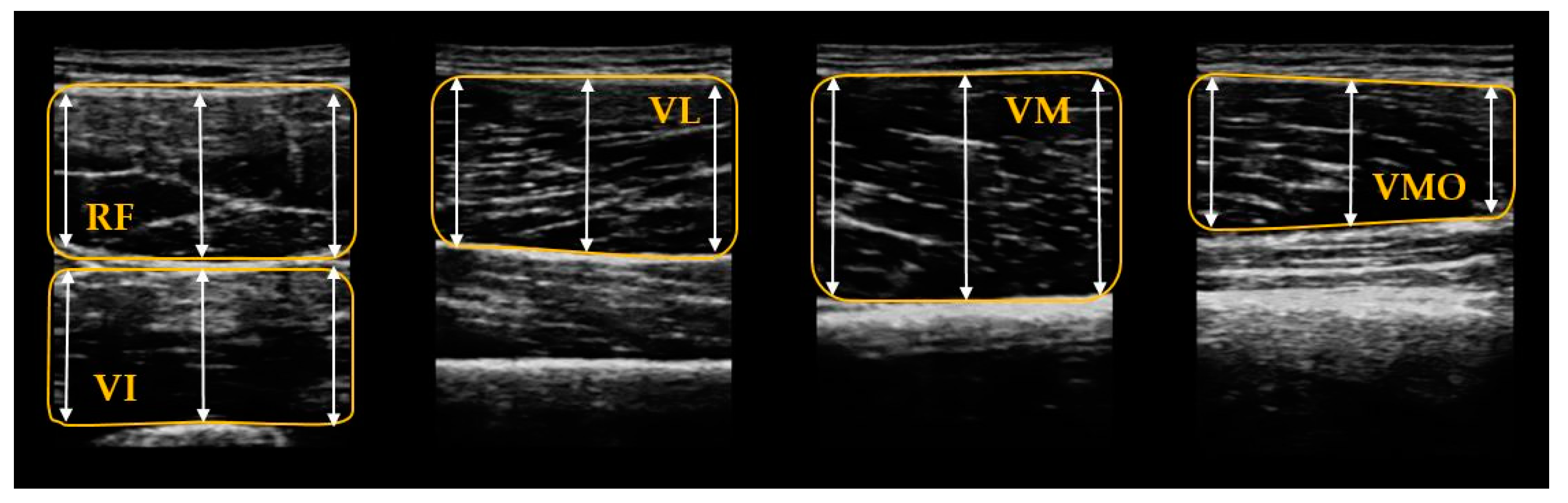 Ijerph 17 04669 g004